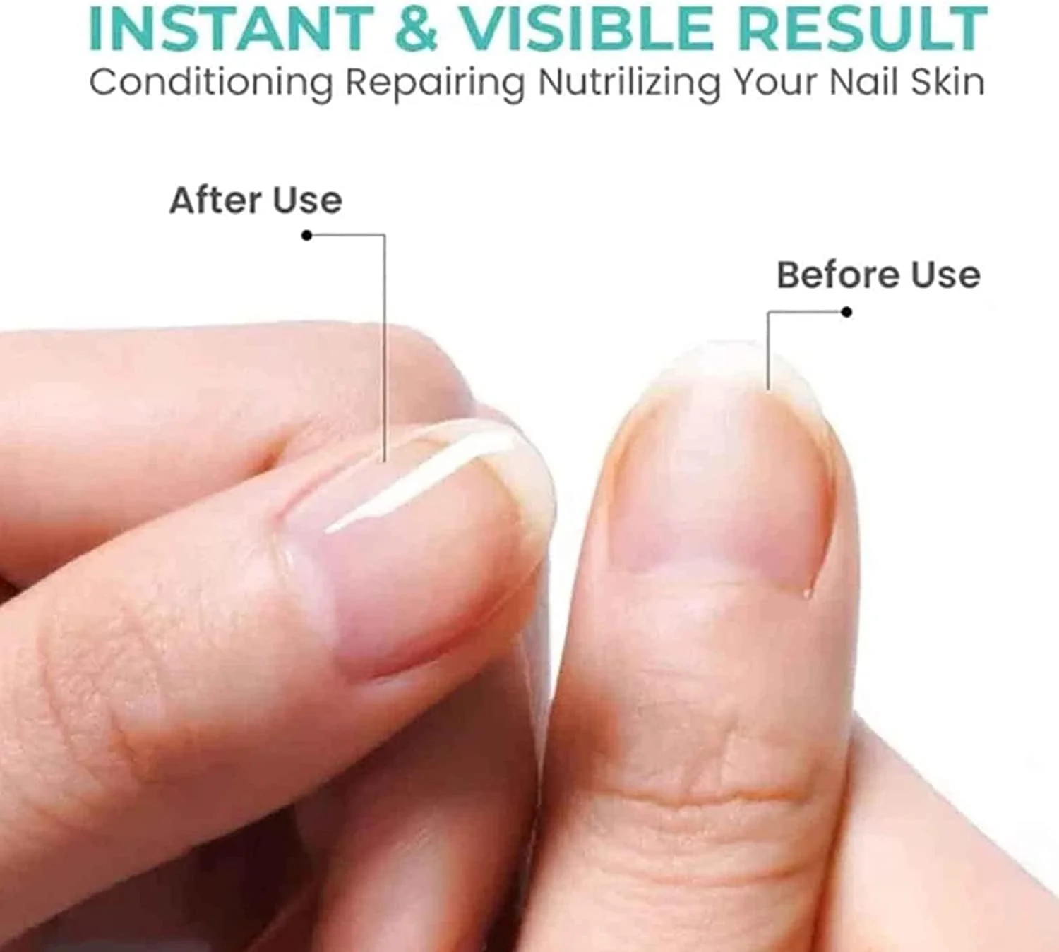 روغن تقویت کننده ناخن و کوتیکول غنی از ویتامین CC، روغن تقویت کننده ناخن و کوتیکول غنی از ویتامین Oveallgo، روغن کوتیکول برای ناخن، روغن تقویت کننده ناخن (درخت چای - 2 عدد)