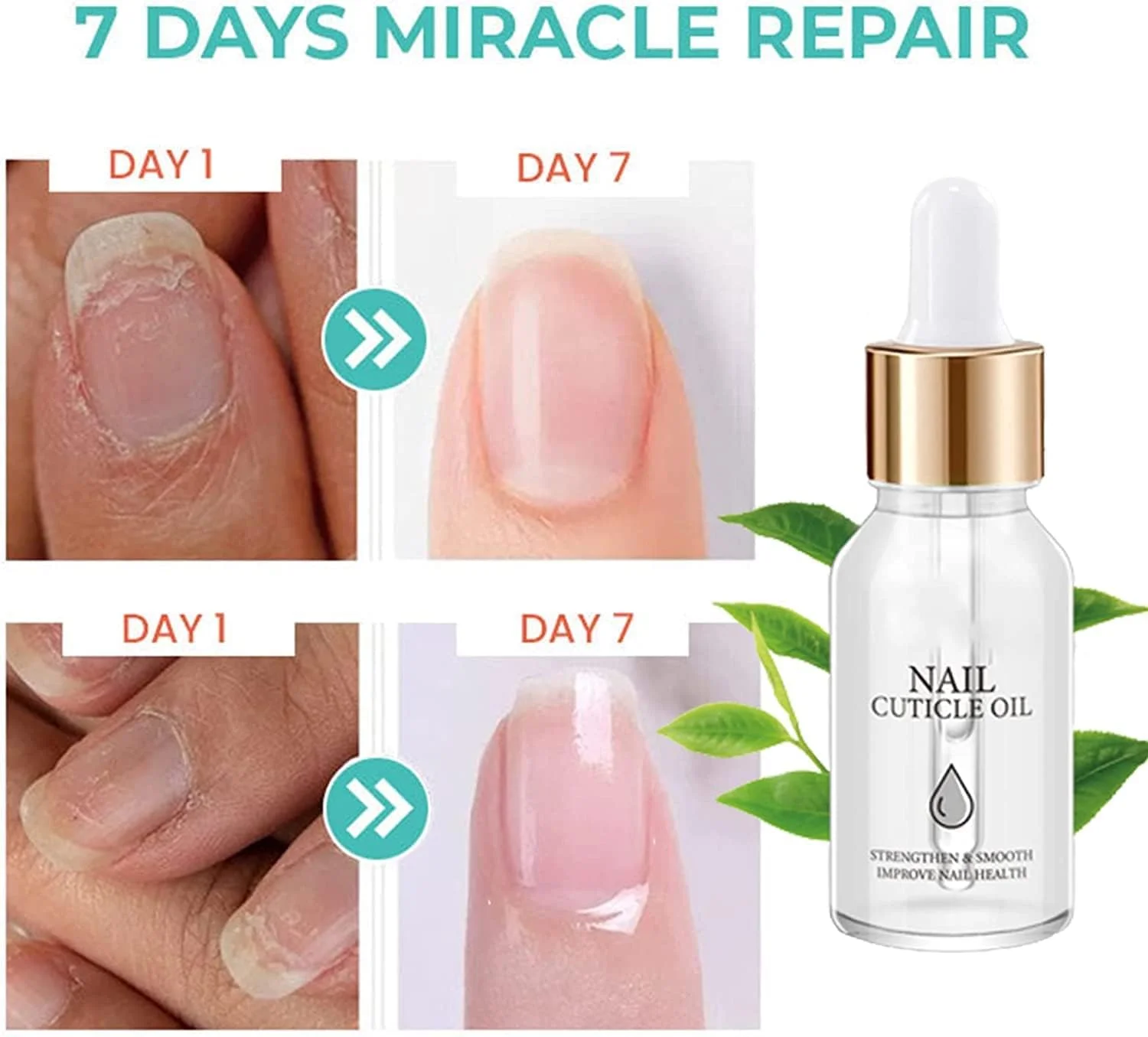 روغن تقویت کننده ناخن و کوتیکول غنی از ویتامین CC، روغن تقویت کننده ناخن و کوتیکول غنی از ویتامین Oveallgo، روغن کوتیکول برای ناخن، روغن تقویت کننده ناخن (درخت چای - 2 عدد)