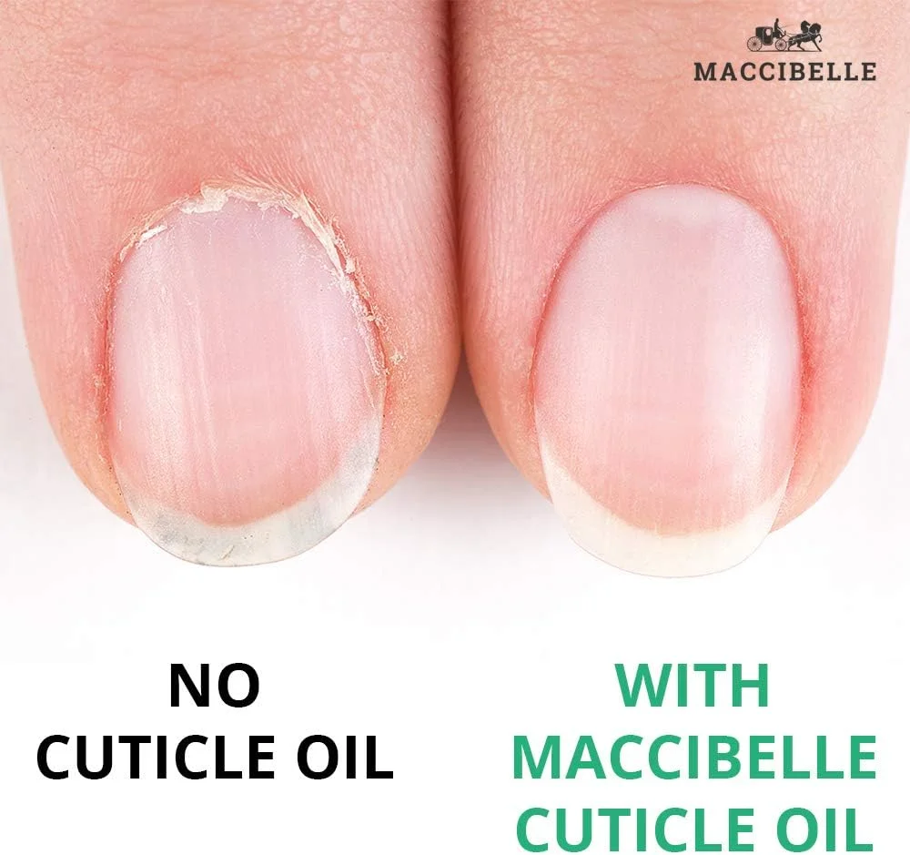 روغن کوتیکول ناخن مکسیبل، سایز بزرگ برای کوتیکول های خشک و ترک خورده (236 میلی لیتر، آناناس) روغن کوتیکول ناخن مکسیبل، سایز بزرگ برای کوتیکول های خشک و ترک خورده (236 میلی لیتر، آناناس)