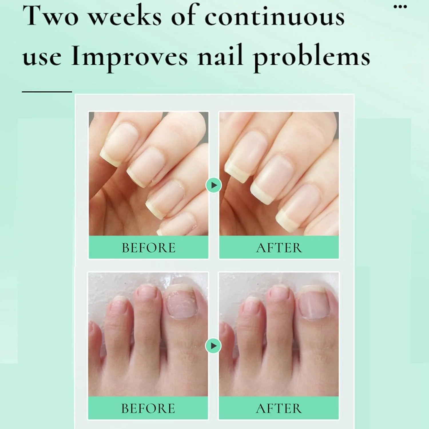 قلم روغن کوتیکول ناخن 10 میلی لیتری 2 عددی، قلم روغن ناخن با مواد طبیعی، روغن کوتیکول مرطوب کننده عمیق برای ناخن ها، جلوگیری از ترک خوردن و خشکی ناخن، درمان ناخن، تقویت کننده لاک ناخن شفاف