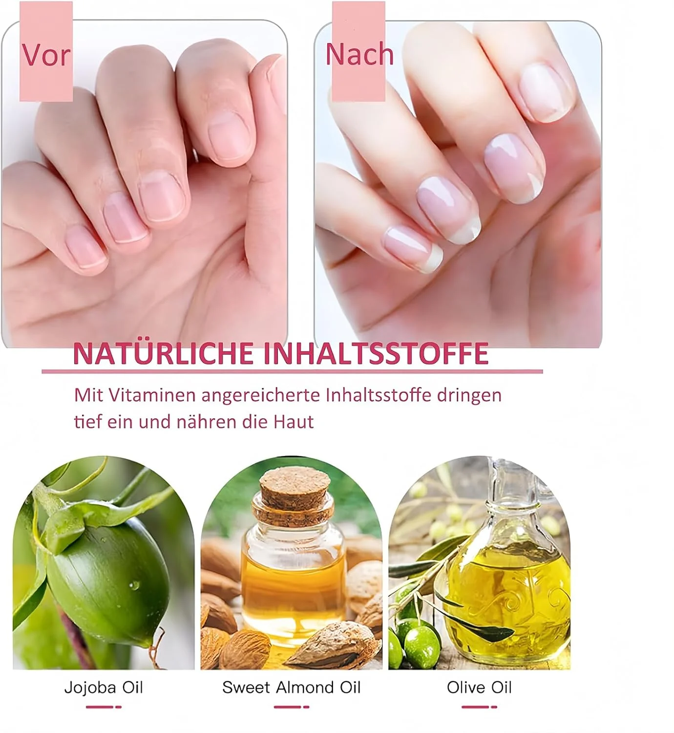 مجموعه قلم روغن ناخن مرطوب کننده کوتیکول برای ناخن های ترک خورده، بسته 8 عددی مجموعه قلم روغن ناخن مرطوب کننده کوتیکول برای ناخن های ترک خورده، بسته 8 عددی