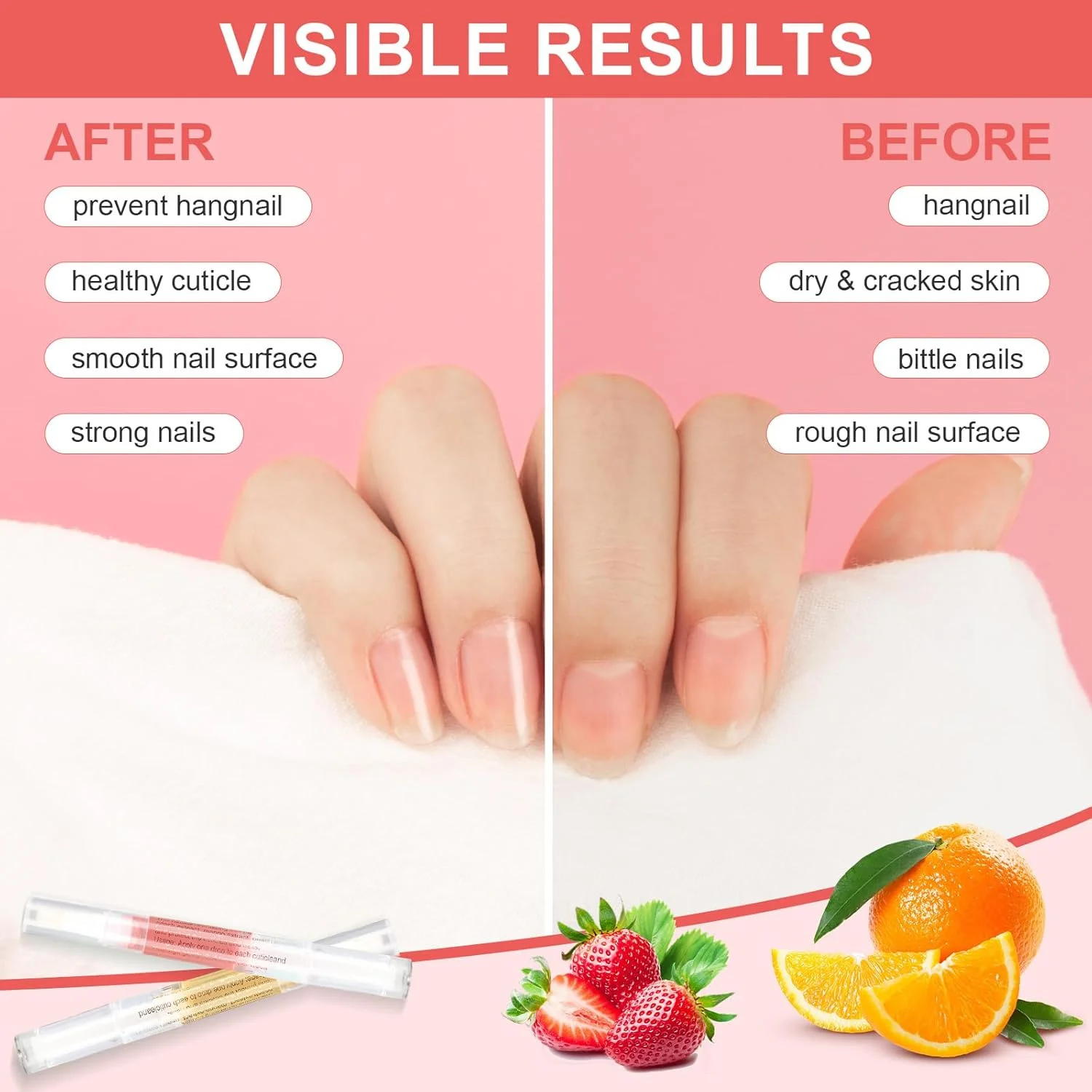 قلم روغن کوتیکول، 3 عدد قلم روغن مغذی به همراه سوهان ناخن، روغن کوتیکول برای ناخن با مواد طبیعی، روغن کوتیکول ناخن برای ترمیم ناخن های ترک خورده و خشک قلم روغن کوتیکول، 3 عدد قلم روغن مغذی به همراه سوهان ناخن، روغن کوتیکول برای ناخن با مواد طبیعی، روغن کوتیکول ناخن برای ترمیم ناخن های ترک خورده و خشک