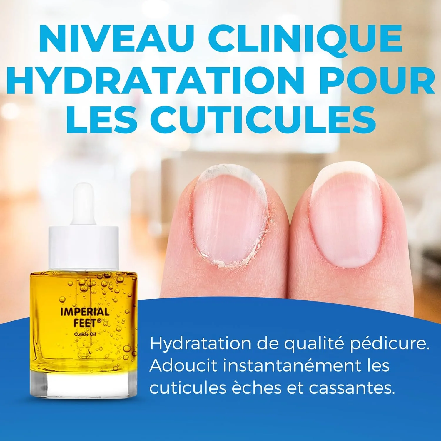 روغن کوتیکول ایمپریال فیت 30 میلی لیتر، مرطوب کننده قوی، تقویت و تغذیه کننده کوتیکول های خشک با روغن ها و ویتامین های طبیعی. محرک رشد سالم ناخن برای داشتن ناخن های نرم و لطیف روغن کوتیکول ایمپریال فیت 30 میلی لیتر، مرطوب کننده قوی، تقویت و تغذیه کننده کوتیکول های خشک با روغن ها و ویتامین های طبیعی. محرک رشد سالم ناخن برای داشتن ناخن های نرم و لطیف