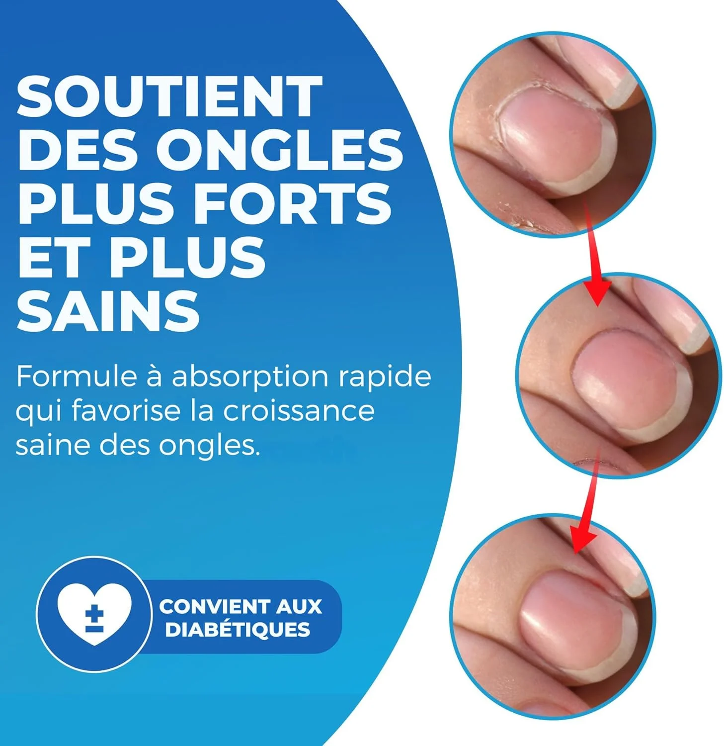 روغن کوتیکول ایمپریال فیت 30 میلی لیتر، مرطوب کننده قوی، تقویت و تغذیه کننده کوتیکول های خشک با روغن ها و ویتامین های طبیعی. محرک رشد سالم ناخن برای داشتن ناخن های نرم و لطیف روغن کوتیکول ایمپریال فیت 30 میلی لیتر، مرطوب کننده قوی، تقویت و تغذیه کننده کوتیکول های خشک با روغن ها و ویتامین های طبیعی. محرک رشد سالم ناخن برای داشتن ناخن های نرم و لطیف