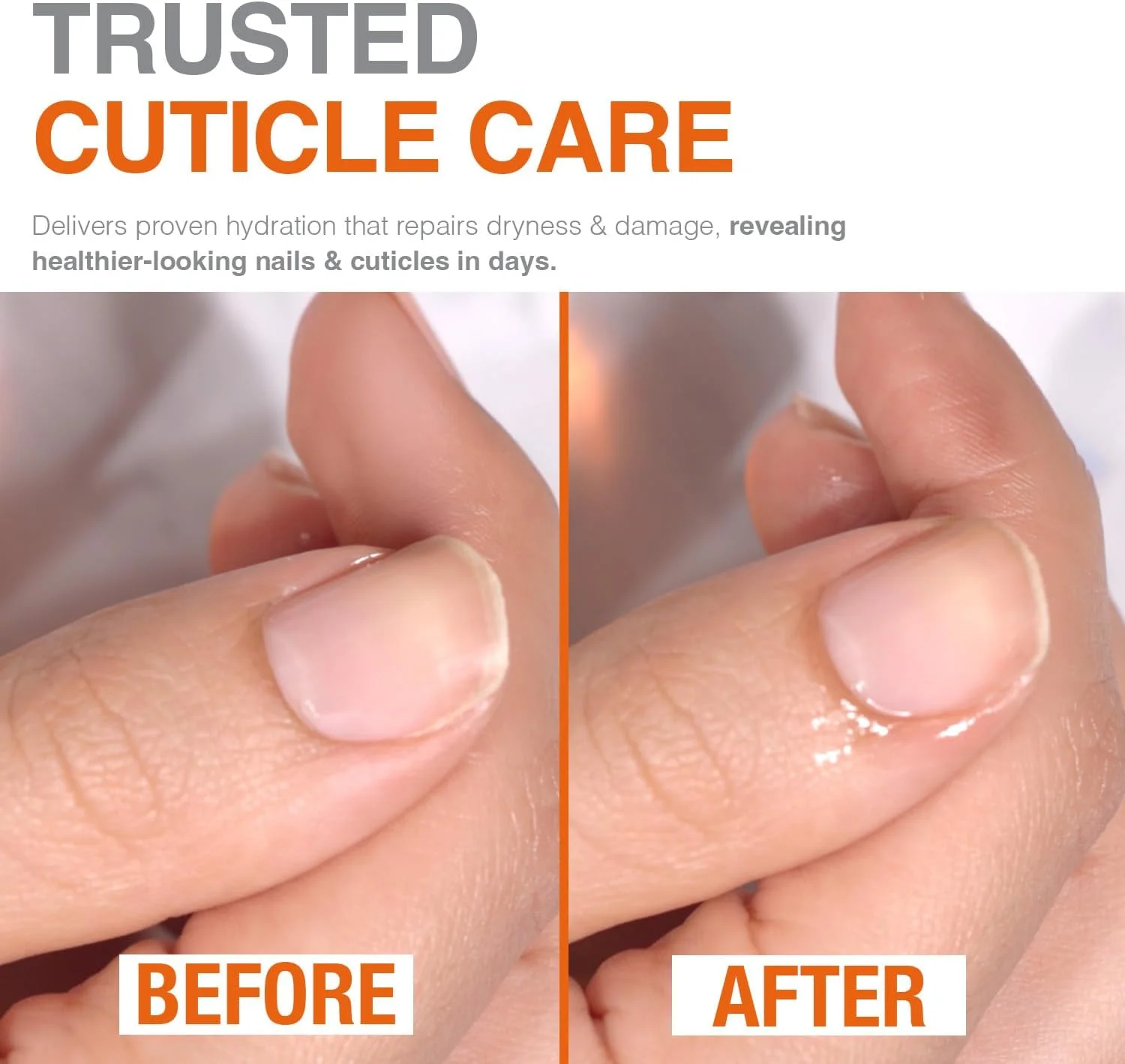 روغن کوتیکول گیاهی روغن دانه کوکویی پروبل، نرم کننده و حالت دهنده کوتیکول ها برای رشد سالم ناخن و کوتیکول. 15 میلی لیتر روغن کوتیکول گیاهی روغن دانه کوکویی پروبل، نرم کننده و حالت دهنده کوتیکول ها برای رشد سالم ناخن و کوتیکول. 15 میلی لیتر