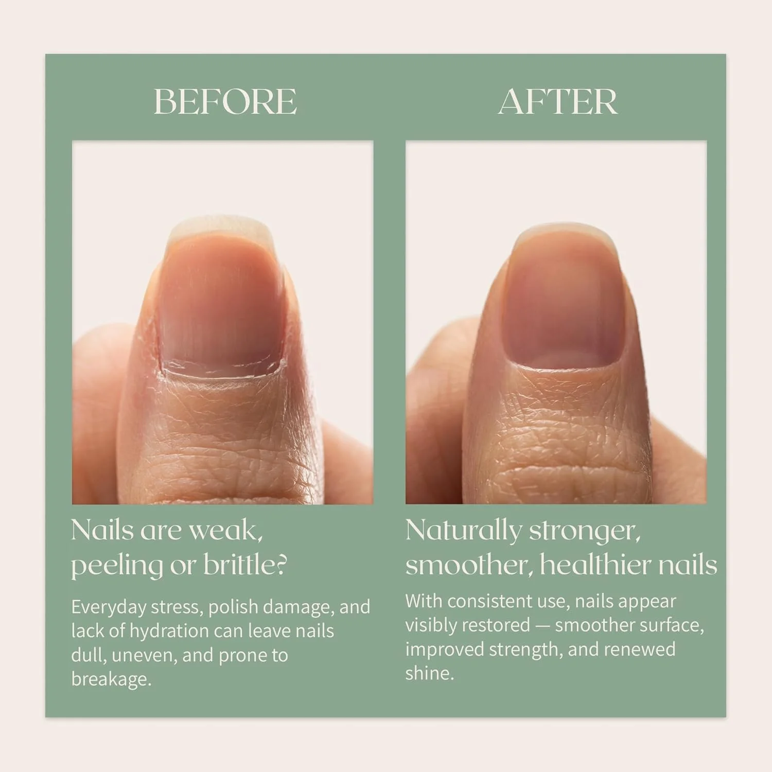 تقویت کننده تنفسی ناخن فیتواسترانگ - روغن کوتیکول و درمان ناخن تنفسی ممتاز برای مراقبت موثر و طبیعی از ناخن - روغن ناخن و روغن کوتیکول زیستی برای ناخن ها و ترمیم ناخن تقویت کننده تنفسی ناخن فیتواسترانگ - روغن کوتیکول و درمان ناخن تنفسی ممتاز برای مراقبت موثر و طبیعی از ناخن - روغن ناخن و روغن کوتیکول زیستی برای ناخن ها و ترمیم ناخن