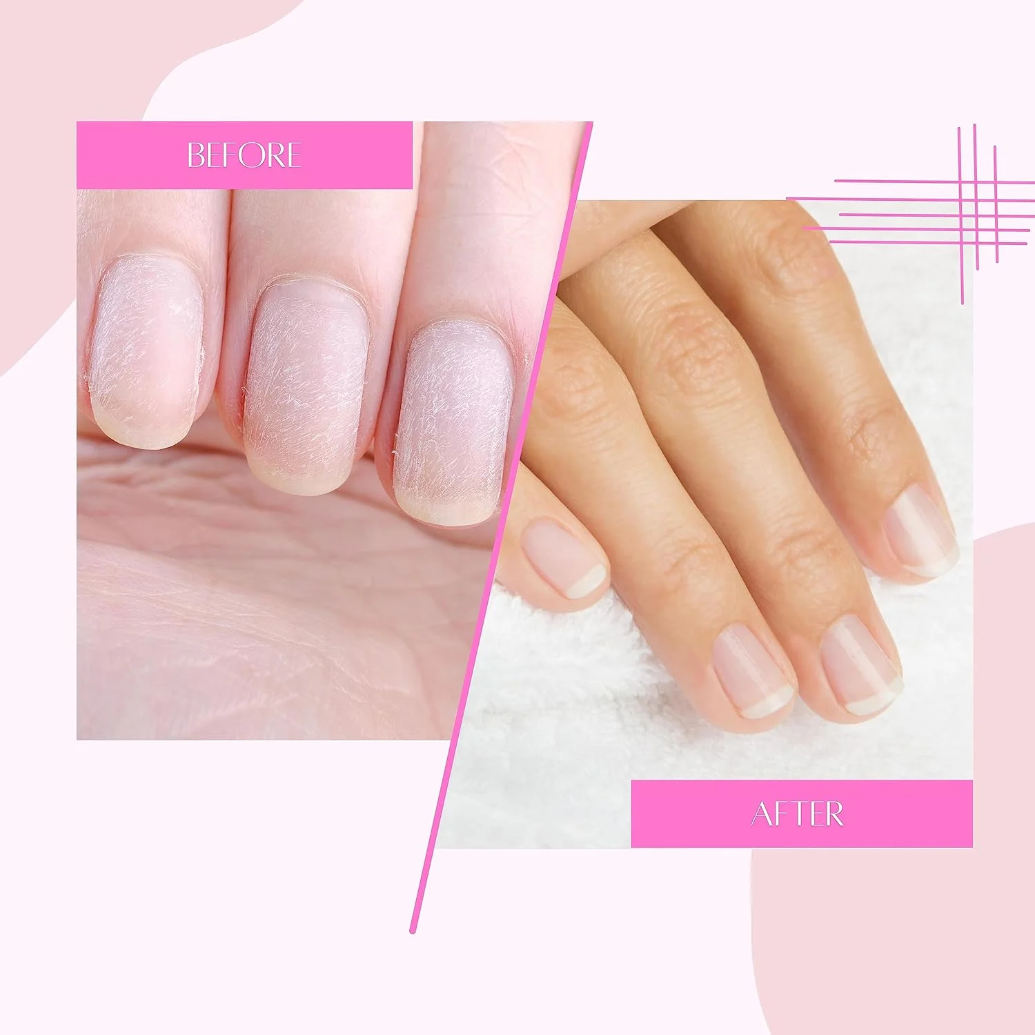 روغن کوتیکول و روغن ناخن نیل استور، روغن احیا کننده کوتیکول - رایحه هلو 15 میلی لیتر