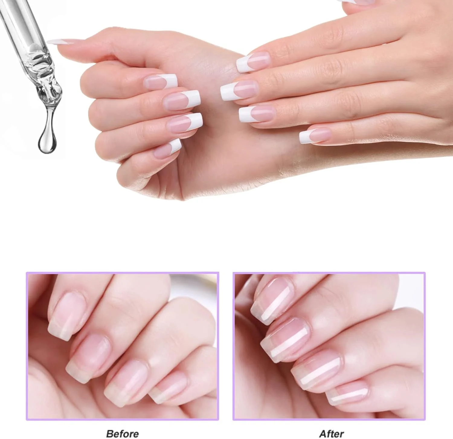 روغن کوتیکول ناخن 15 میلی لیتر حاوی ویتامین E و B، روغن کوتیکول برای ناخن، روغن کوتیکول ناخن جوجوبا، روغن ناخن تسکین دهنده و مرطوب کننده با طراحی قطره چکان برای ترمیم و مراقبت از ناخن های خشک و زبر (اسطوخودوس) روغن کوتیکول ناخن 15 میلی لیتر حاوی ویتامین E و B، روغن کوتیکول برای ناخن، روغن کوتیکول ناخن جوجوبا، روغن ناخن تسکین دهنده و مرطوب کننده با طراحی قطره چکان برای ترمیم و مراقبت از ناخن های خشک و زبر (اسطوخودوس)