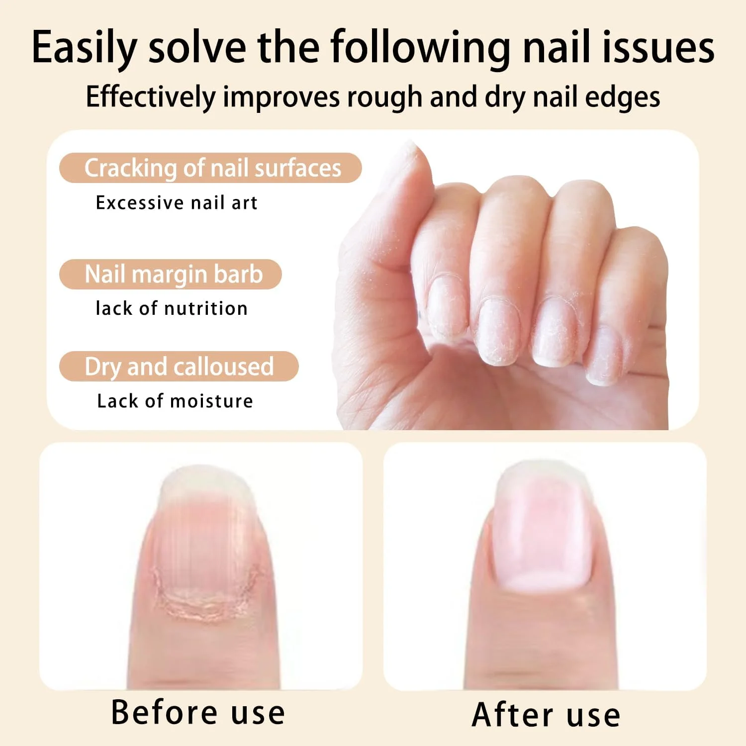 روغن کوتیکول قلمی برای مراقبت از ناخن، روغن ناخن برای استحکام، تغذیه و مرطوب کردن کوتیکول برای کاهش ترک خوردگی و خشکی ناخن های ضعیف، شکننده و نازک (زغال اخته و گیلاس) روغن کوتیکول قلمی برای مراقبت از ناخن، روغن ناخن برای استحکام، تغذیه و مرطوب کردن کوتیکول برای کاهش ترک خوردگی و خشکی ناخن های ضعیف، شکننده و نازک (زغال اخته و گیلاس)