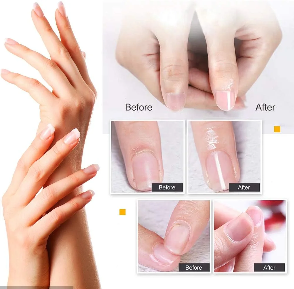 روغن کوتیکول، روغن های کوتیکول، روغن کوتیکول ناخن، قلم روغن ناخن، قلم روغن تغذیه ژل ناخن، درمان روغن احیا کننده کوتیکول روغن کوتیکول، روغن های کوتیکول، روغن کوتیکول ناخن، قلم روغن ناخن، قلم روغن تغذیه ژل ناخن، درمان روغن احیا کننده کوتیکول