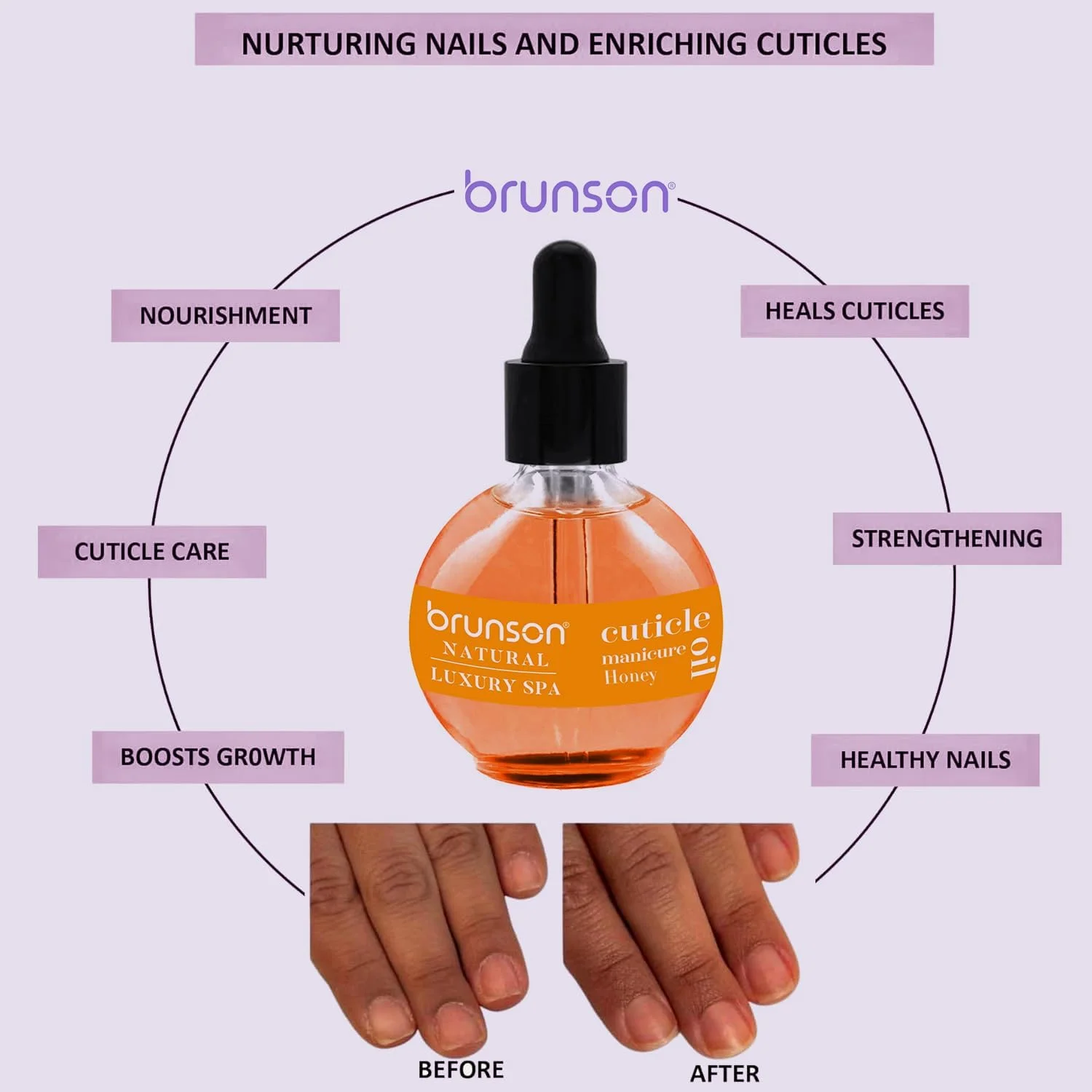 روغن کوتیکول برونسون 75 میلی لیتر، سرم درمان ناخن برای تقویت، روغن کوتیکول با عصاره طبیعی برای رشد ناخن، روغن مغذی برای ناخن ها و کوتیکول ها روغن کوتیکول برونسون 75 میلی لیتر، سرم درمان ناخن برای تقویت، روغن کوتیکول با عصاره طبیعی برای رشد ناخن، روغن مغذی برای ناخن ها و کوتیکول ها