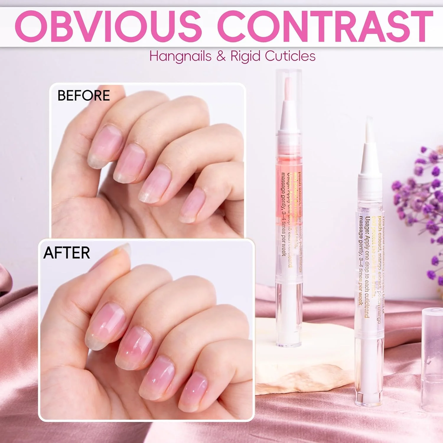 قلم روغن کوتیکول ناخن، قلم روغن ناخن برای مراقبت از ناخن، روغن کوتیکول برای ناخن با سوهان ناخن، جلوگیری از خشکی، ترک خوردگی و آویزان شدن پوست (رایحه گل رز و یاس) قلم روغن کوتیکول ناخن، قلم روغن ناخن برای مراقبت از ناخن، روغن کوتیکول برای ناخن با سوهان ناخن، جلوگیری از خشکی، ترک خوردگی و آویزان شدن پوست (رایحه گل رز و یاس)