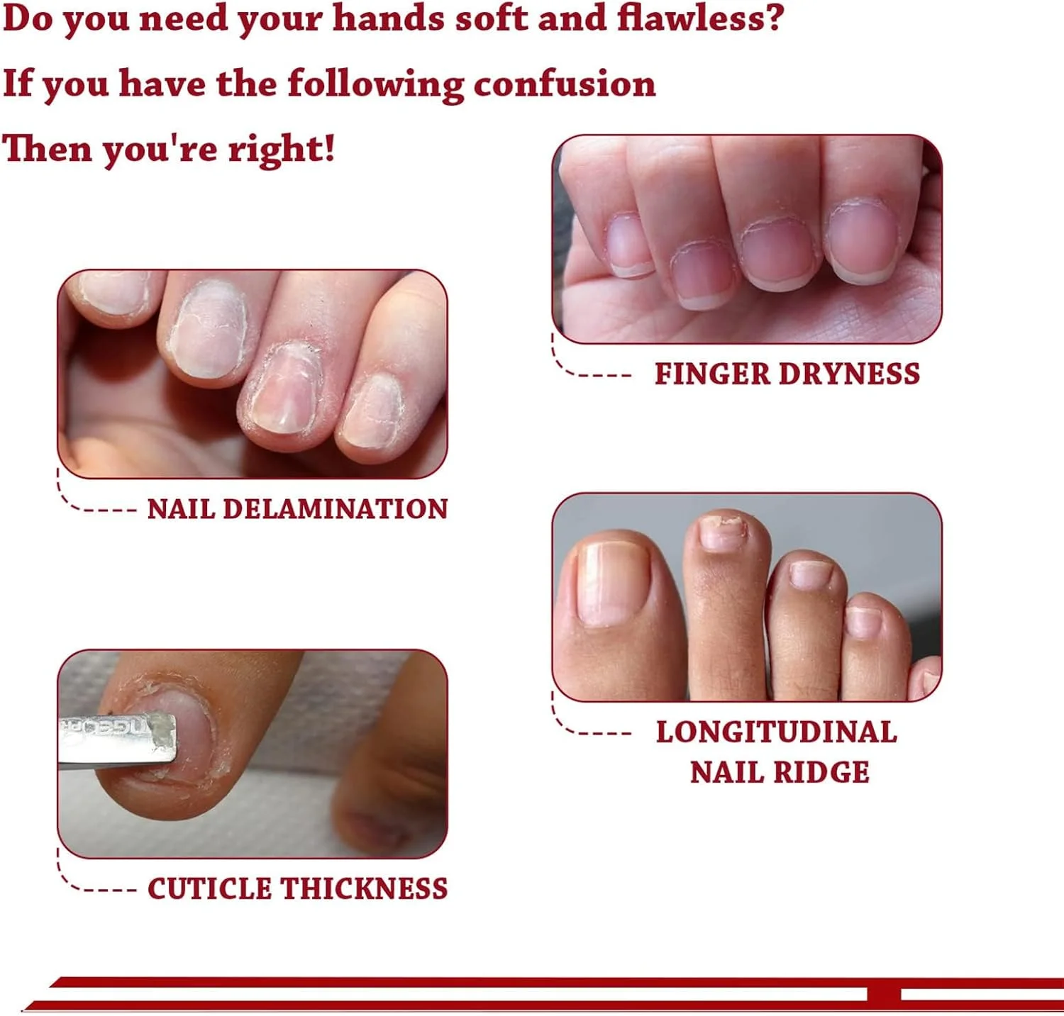 روغن کوتیکول ناخن نالاکال 30 میلی لیتر، روغن کوتیکول ناخن با رایحه گیلاس، روغن کوتیکول ناخن جوجوبا حاوی ویتامین B و E، مرطوب کننده پوست کوتیکول و ناخن، تقویت کننده ناخن، جلوگیری از ریش ریش شدن و ترک خوردن روغن کوتیکول ناخن نالاکال 30 میلی لیتر، روغن کوتیکول ناخن با رایحه گیلاس، روغن کوتیکول ناخن جوجوبا حاوی ویتامین B و E، مرطوب کننده پوست کوتیکول و ناخن، تقویت کننده ناخن، جلوگیری از ریش ریش شدن و ترک خوردن