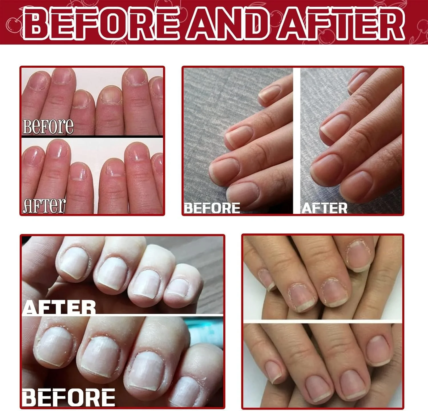 روغن کوتیکول ناخن نالاکال 30 میلی لیتر، روغن کوتیکول ناخن با رایحه گیلاس، روغن کوتیکول ناخن جوجوبا حاوی ویتامین B و E، مرطوب کننده پوست کوتیکول و ناخن، تقویت کننده ناخن، جلوگیری از ریش ریش شدن و ترک خوردن روغن کوتیکول ناخن نالاکال 30 میلی لیتر، روغن کوتیکول ناخن با رایحه گیلاس، روغن کوتیکول ناخن جوجوبا حاوی ویتامین B و E، مرطوب کننده پوست کوتیکول و ناخن، تقویت کننده ناخن، جلوگیری از ریش ریش شدن و ترک خوردن