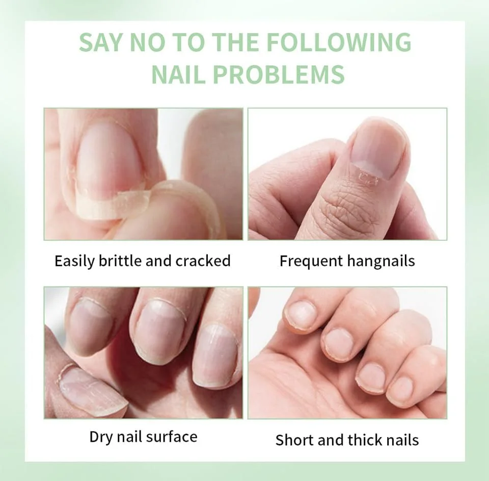 روغن کوتیکول قلمی برای مراقبت از ناخن، قلم روغن ناخن 5 میلی لیتری با مواد طبیعی برای مرطوب کردن و تغذیه ناخن ها و کوتیکول های خشک، روغن کوتیکول برای جلوگیری از ترک خوردن ناخن و ریش ریش شدن، آلوئه ورا