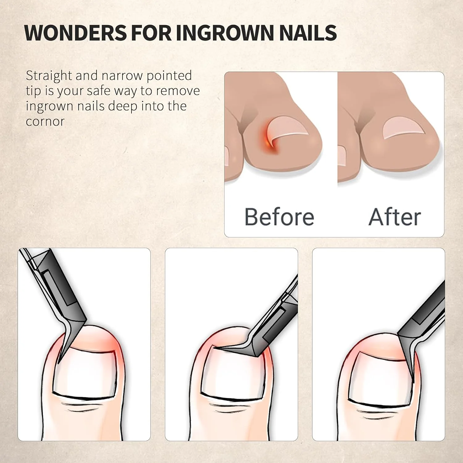 ناخن گیر ناخن پا FERYES با تیغه صاف برای ناخن های فرورفته و ضخیم - فولاد ضد زنگ و نوک تیز - ابزار پدیکور ناخن گیر با فک پهن - خاکستری تیره ناخن گیر ناخن پا FERYES با تیغه صاف برای ناخن های فرورفته و ضخیم - فولاد ضد زنگ و نوک تیز - ابزار پدیکور ناخن گیر با فک پهن - خاکستری تیره