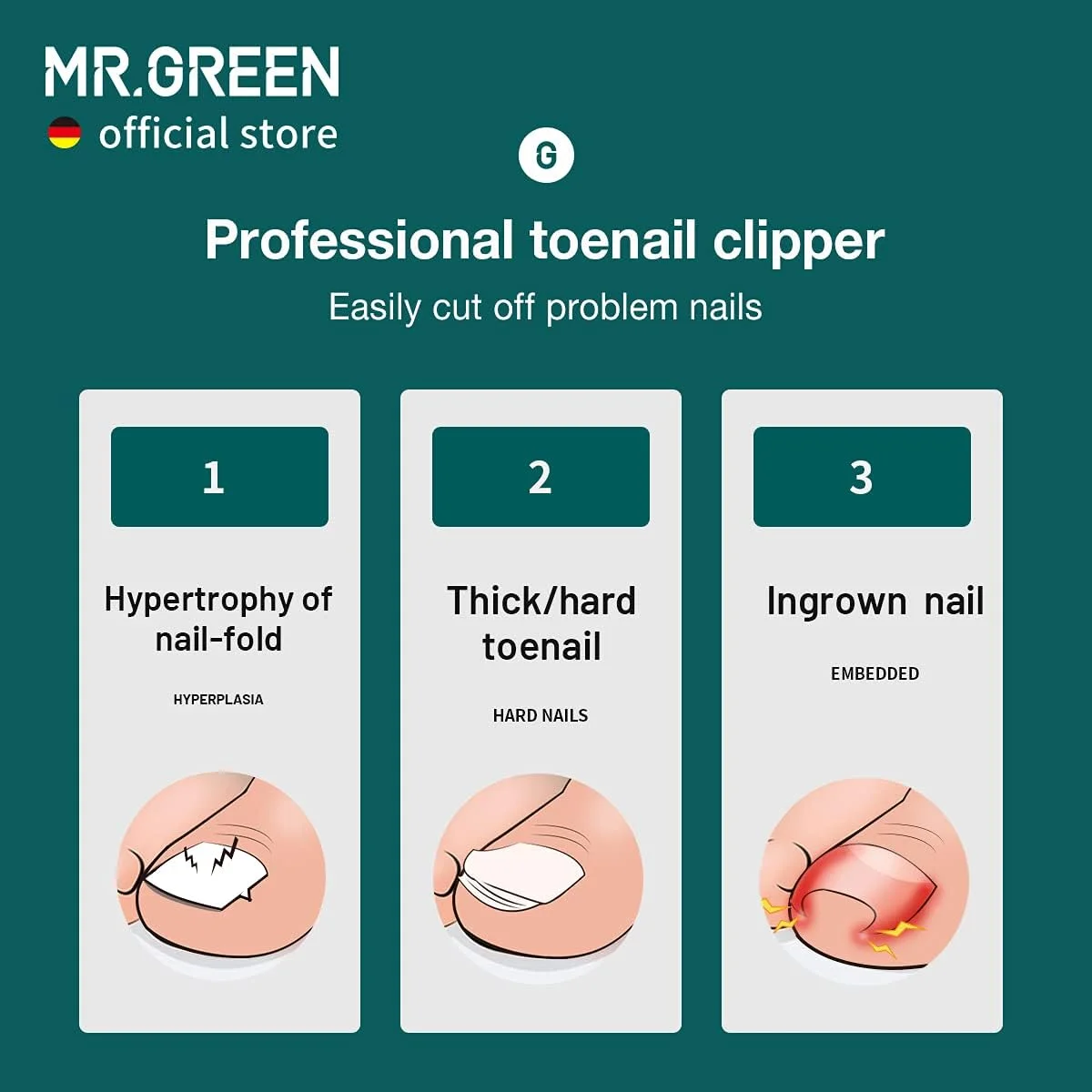 ناخن گیر MR.GREEN، قیچی ناخن پا، ضد پاشش، حرفه ای، مناسب ناخن های ضخیم و سخت، ابزار پدیکور، ست های مانیکور (دسته آبی)