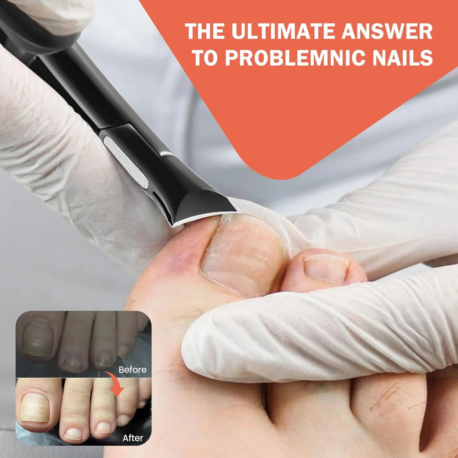 ناخن گیر انگشتان پا BEZOX برای ناخن های ضخیم - ناخن گیر بزرگ و دقیق برای آقایان و بانوان، ناخن گیر با دسته راحت، قیچی و اصلاح کننده ناخن ارگونومیک با دسته بلند و جمع کننده ناخن گیر انگشتان پا BEZOX برای ناخن های ضخیم - ناخن گیر بزرگ و دقیق برای آقایان و بانوان، ناخن گیر با دسته راحت، قیچی و اصلاح کننده ناخن ارگونومیک با دسته بلند و جمع کننده