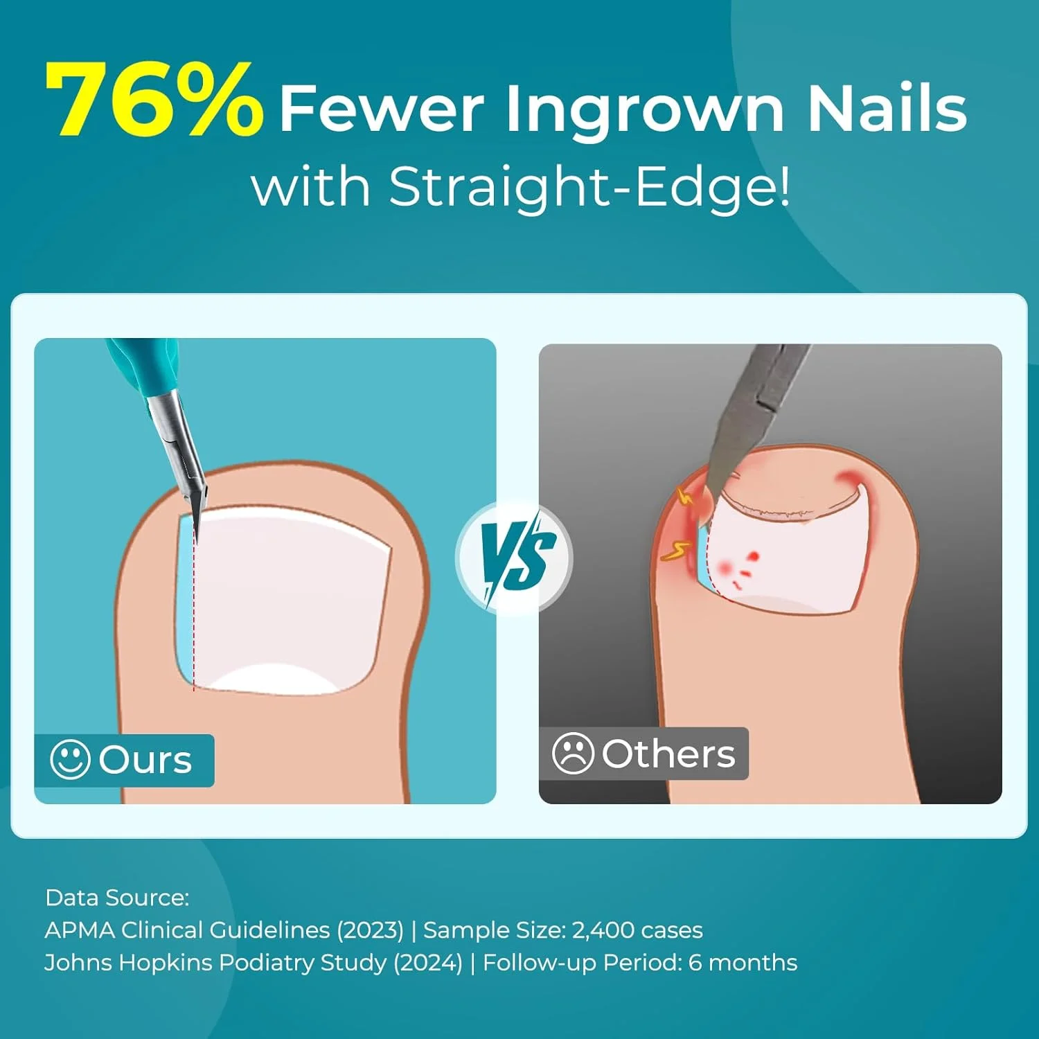 ناخن گیر حرفه ای وانمت: ناخن گیر لبه صاف برای آقایان و بانوان - دوندگان/ورزشکاران 16-45 ساله - ناخن گیر جمع و جور برای کیف ورزشی/مسافرت ناخن گیر حرفه ای وانمت: ناخن گیر لبه صاف برای آقایان و بانوان - دوندگان/ورزشکاران 16-45 ساله - ناخن گیر جمع و جور برای کیف ورزشی/مسافرت