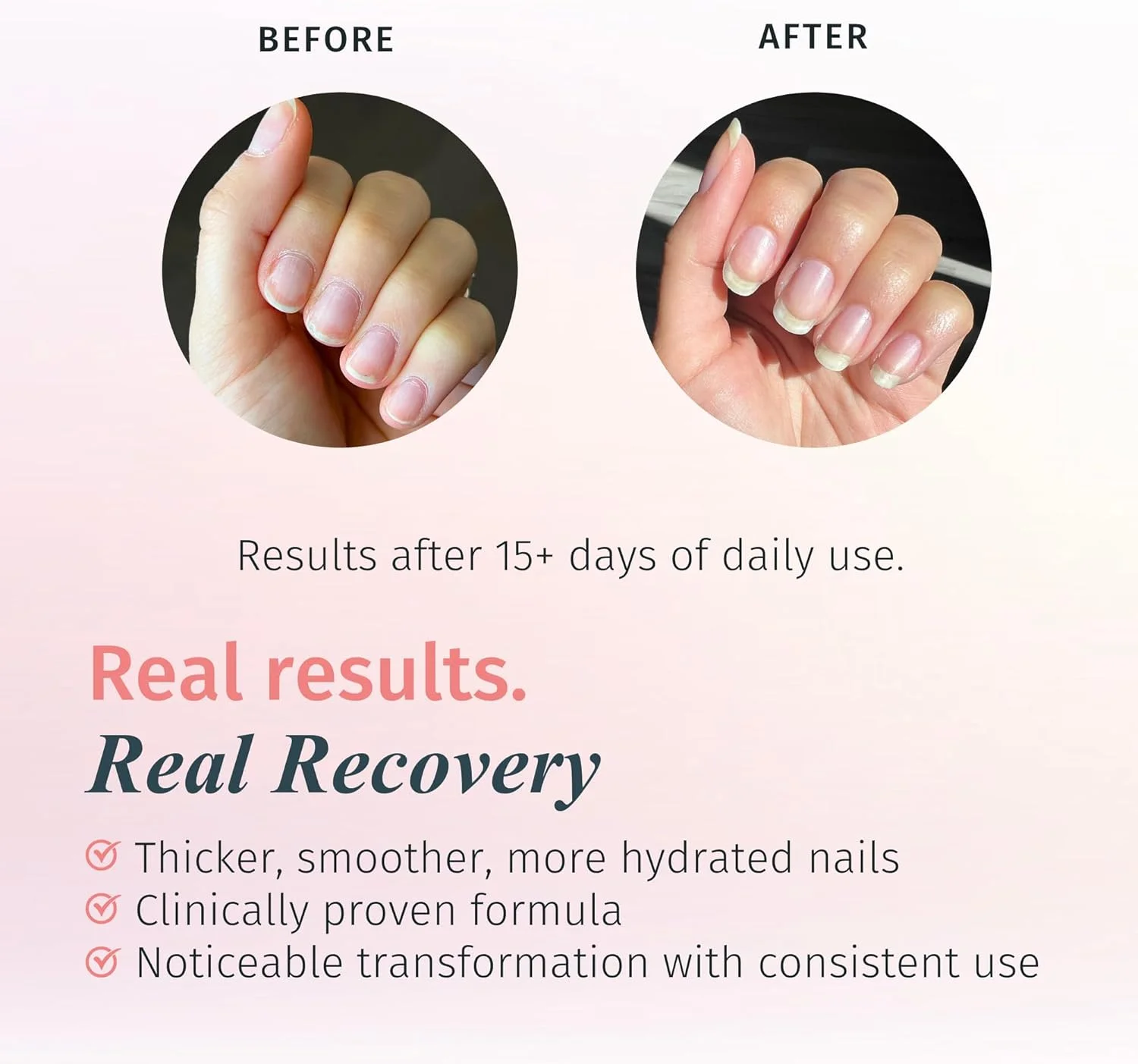 سیستم رشد ناخن دوری Rejuvacote 1 - فرمول اصلی با حداکثر قدرت - تقویت کننده و رشد ناخن - لایه پایه و رویه - 13.3 میلی لیتر