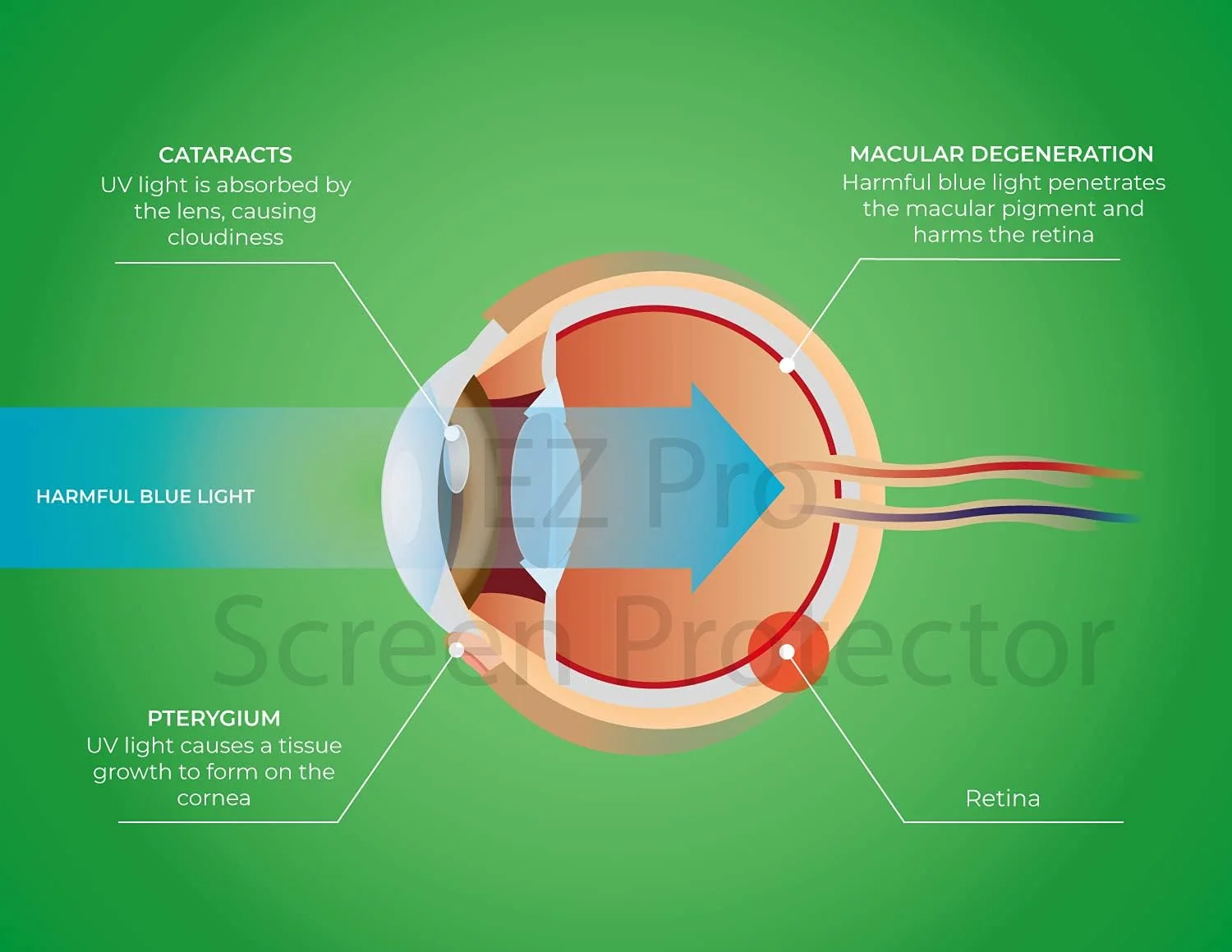 محافظ صفحه نمایش ضد نور آبی (بسته 3 عددی) برای کروم بوک 11.6 اینچی لنوو، کروم بوک 11.6 اینچی ایسر، کروم بوک 11.6 اینچی ایسوس، کروم بوک 11.6 اینچی سامسونگ، کروم بوک 11.6 اینچی دل، کروم بوک 11.6 اینچی اچ پی