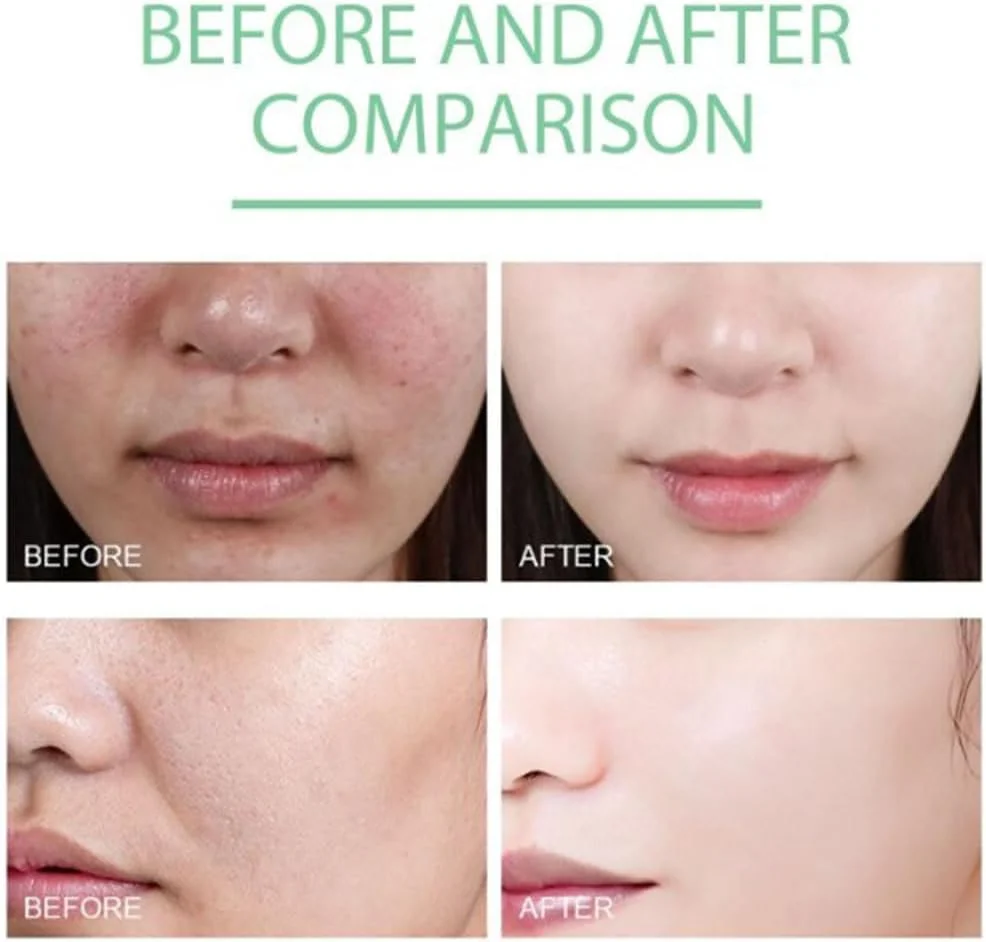 ژل لایه بردار پاک کننده، 2 عدد 100 گرم اسکراب لایه بردار ملایم صورت، اسکراب ژل لایه بردار طبیعی بدن، بهبود رنگ و بافت پوست، فرمول ضد حساسیت، مناسب برای انواع پوست