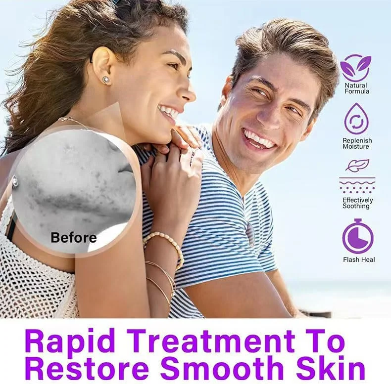 کرم ضد جوش حاوی 15% آزلائیک اسید، سرم آزلائیک اسید، ویتامین C و هیالورونیک اسید و نیاسینامید، درمان صورت برای رفع قرمزی، صاف کننده پوست و لک، پاک کننده منافذ (1 عدد) کرم ضد جوش حاوی 15% آزلائیک اسید، سرم آزلائیک اسید، ویتامین C و هیالورونیک اسید و نیاسینامید، درمان صورت برای رفع قرمزی، صاف کننده پوست و لک، پاک کننده منافذ (1 عدد)