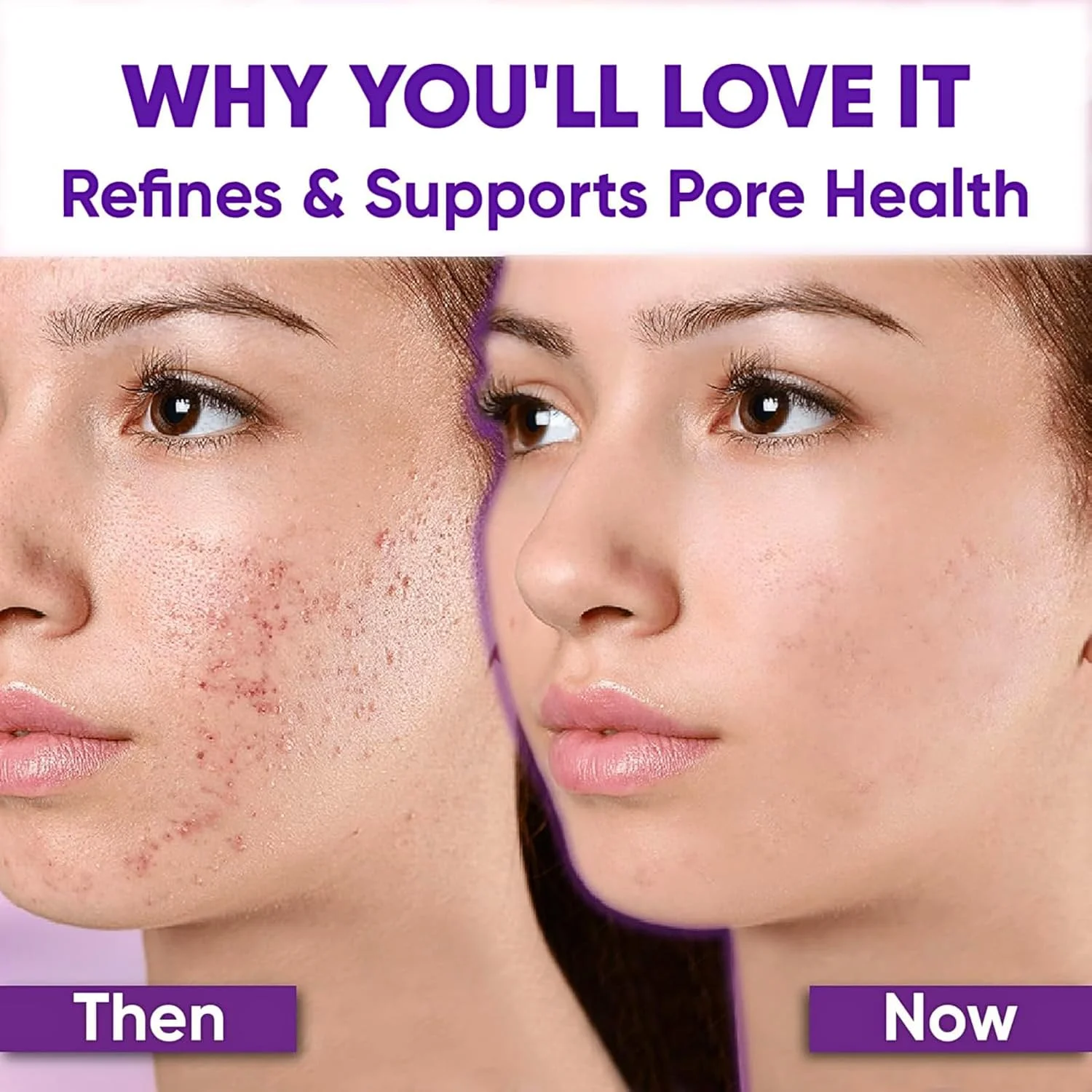 کرم مرطوب کننده شب، کرم سرم صورت اسید 12%، از بین برنده لک های تیره، نیاسینامید و مراقبت از پوست ویتامین C، درمان رزاسه، تسکین قرمزی جوش آکنه، تعادل سبوم، مراقبت روزانه از پوست