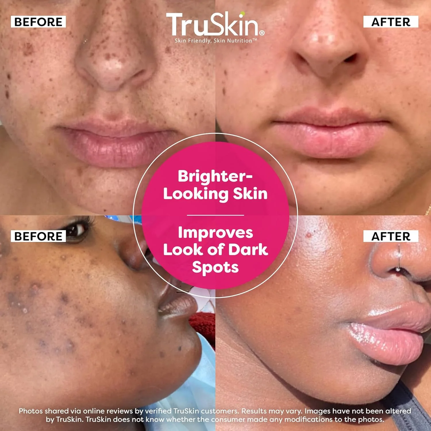 سرم صورت سوپر ویتامین C ترواسکین حاوی نیاسینامید، رتینول، هیالورونیک و سالیسیلیک اسید (BHA) - سرم صورت ضد پیری همه کاره برای روشن کنندگی، سفت کنندگی، لکه های تیره، تغییر رنگ - 2 fl oz