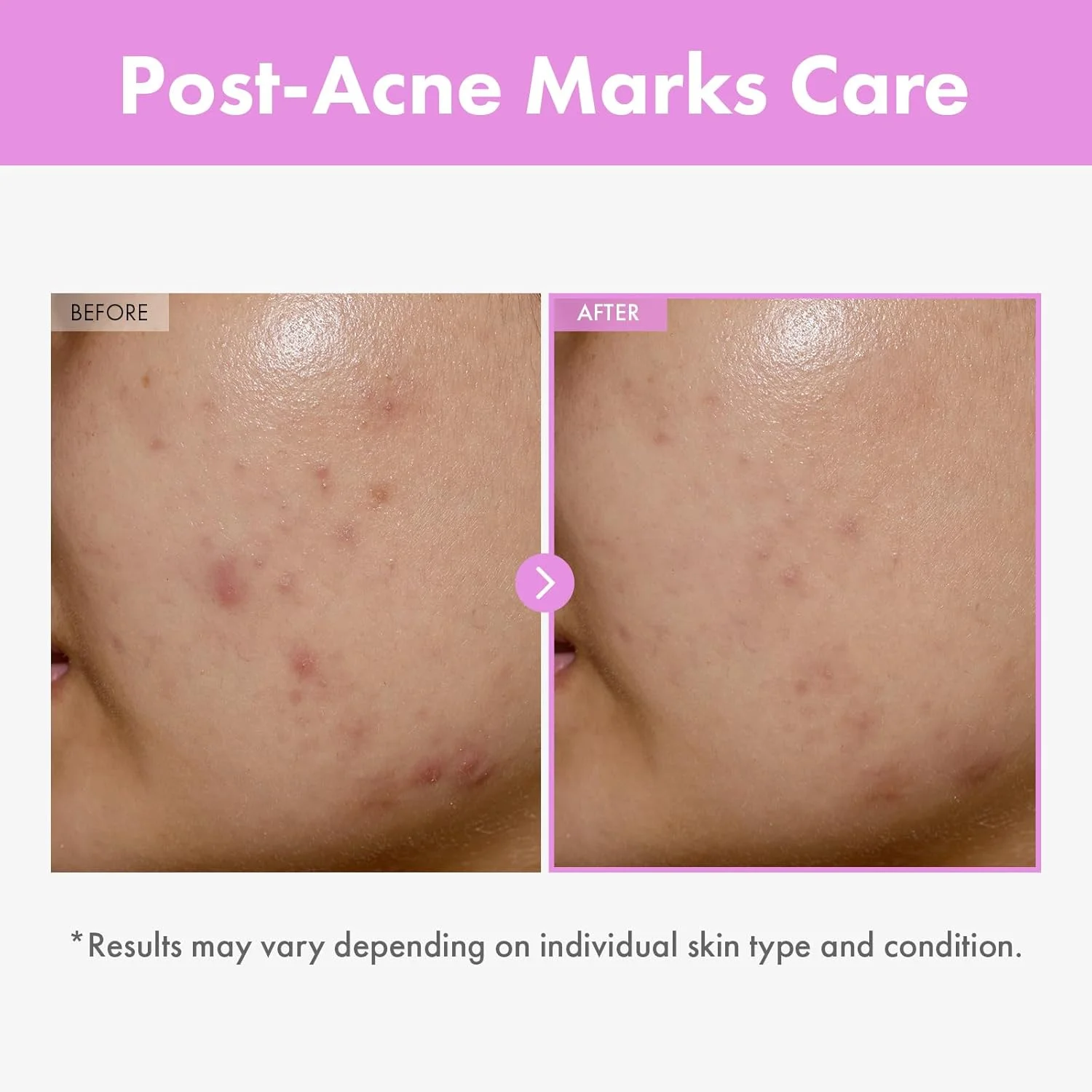 سرم تقویت کننده پوست 9 پپتیدی توسوونگ، اسانس صورت نیاسینامید و هیالورونیک اسید برای انواع پوست، مراقبت از پوست کره ای، بدون پارابن، 150 میلی لیتر سرم تقویت کننده پوست 9 پپتیدی توسوونگ، اسانس صورت نیاسینامید و هیالورونیک اسید برای انواع پوست، مراقبت از پوست کره ای، بدون پارابن، 150 میلی لیتر