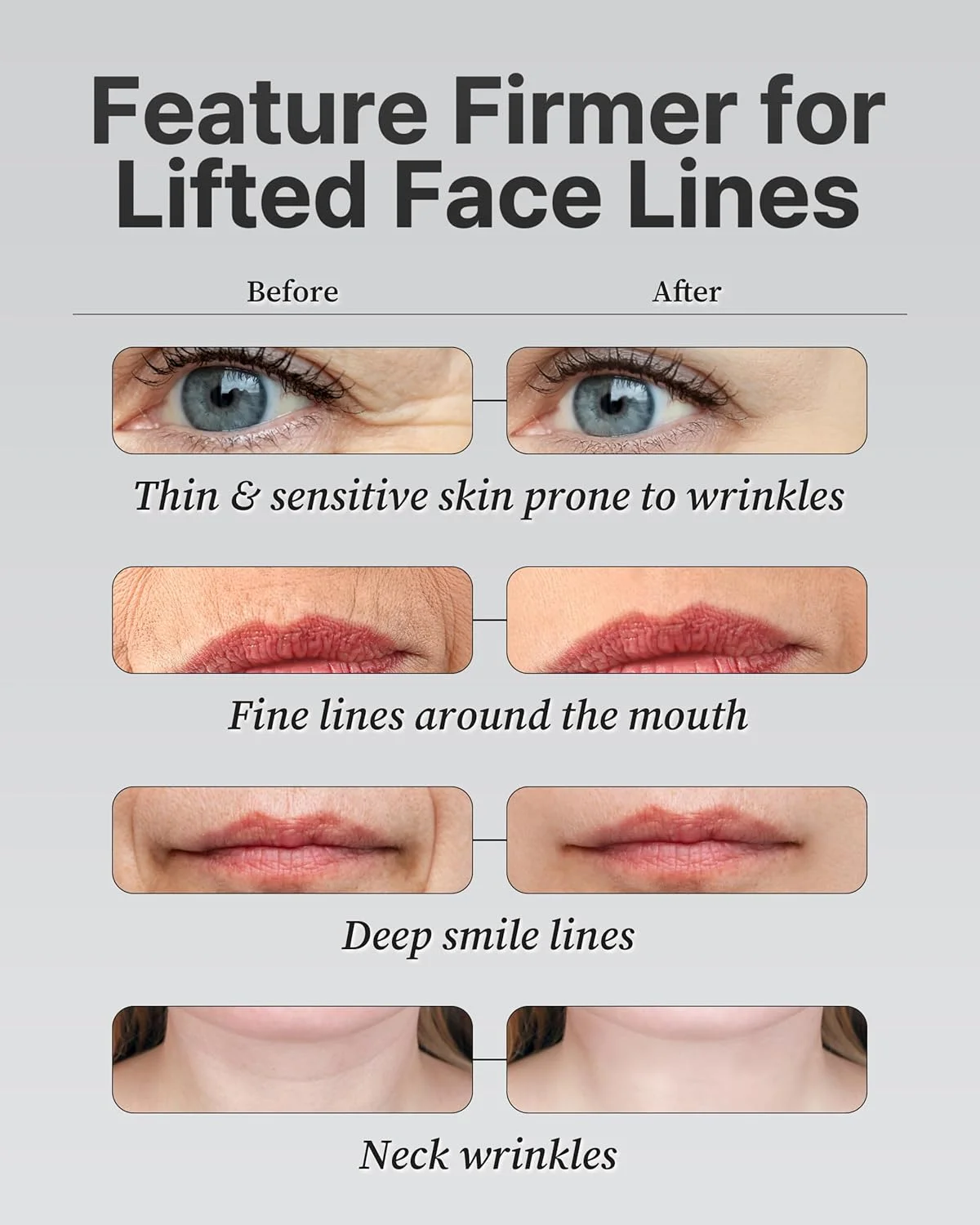 سرم صورت پیشرفته نُه دُم برای لیفتینگ خطوط | سرم صورت ضد پیری، روغن صورت کره‌ای حاوی کلاژن، سنتلا آسیاتیکا، سرامید، هیالورونیک اسید و موارد دیگر | سرم ترمیم کننده روز و شب برای خطوط ریز 6 میلی لیتر