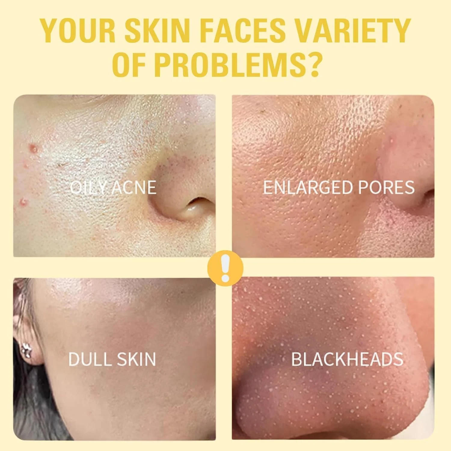 ماسک صورت لایه بردار، مراقبت از پوست با ماسک صورت، ماسک لایه بردار زیبایی صورت، ماسک پاک کننده جوش های سر سیاه، ماسک پاک کننده عمیق صورت، از بین برنده آلودگی ها، بهبود ناهمواری پوست، کنترل چربی