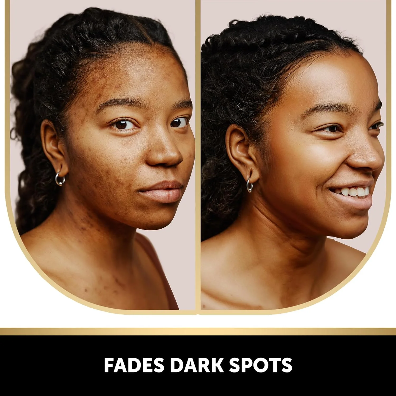 بسته چهارتایی صابون روشن کننده لکه‌های تیره حاوی کوجیک اسید، ویتامین C، رتینول، کلاژن و زردچوبه به همراه یک جفت دستکش لایه‌بردار مشکی