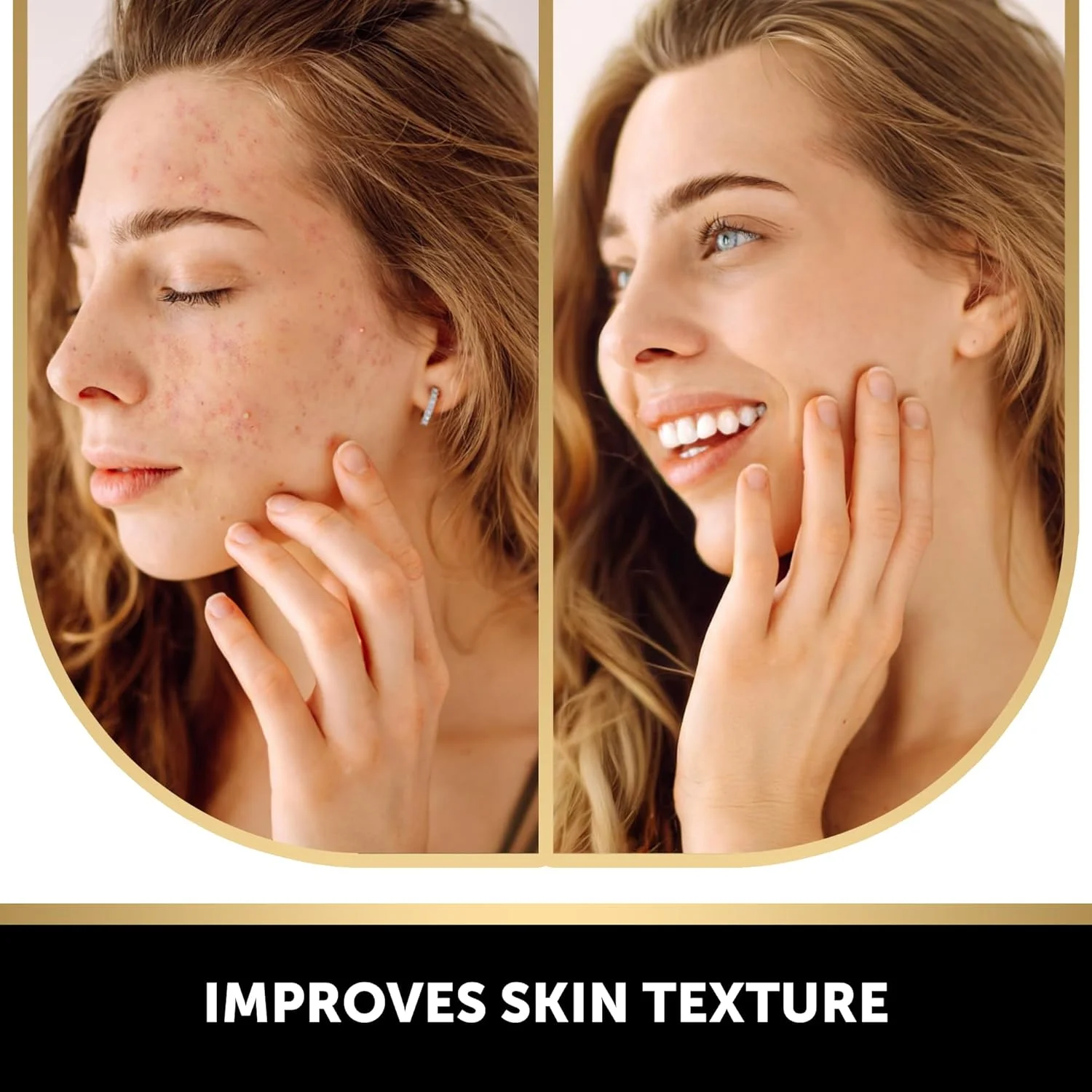 بسته چهارتایی صابون روشن کننده لکه‌های تیره حاوی کوجیک اسید، ویتامین C، رتینول، کلاژن و زردچوبه به همراه یک جفت دستکش لایه‌بردار مشکی