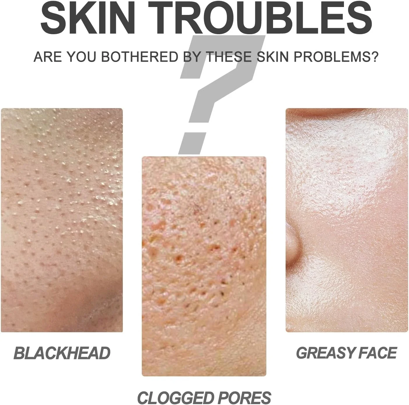 کرم پاک کننده جوش سرسیاه، پاکسازی عمیق، مقابله با آکنه و جوش های سرسیاه، لایه برداری ملایم، ترمیم و احیای پوست، کاهش اندازه منافذ، استفاده آسان، نوارهای بینی لایه بردار 60 عددی