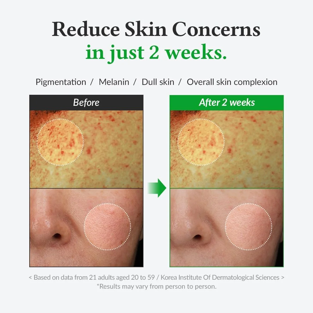 سرم ویتامین C ملایم دکتر آلتئا | بهبود رنگ و لکه‌های پوستی | ملایم برای پوست و یکنواخت کننده رنگ پوست | مراقبت از پوست وگان کره‌ای مناسب برای انواع پوست (ویتامین C ملایم)