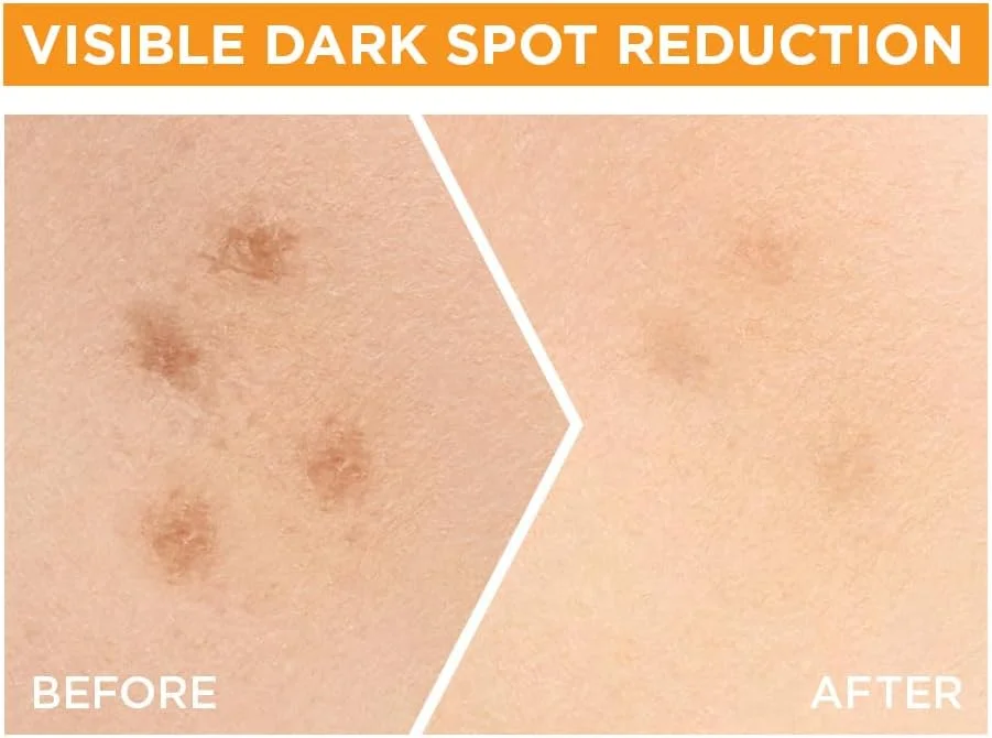 سرم صورت روشن کننده سریع گارنیه، روشن کننده پوست تا 30 برابر، برای پوستی بدون لک، حاوی ویتامین C و نیاسینامید، SkinActive، 50 میلی لیتر