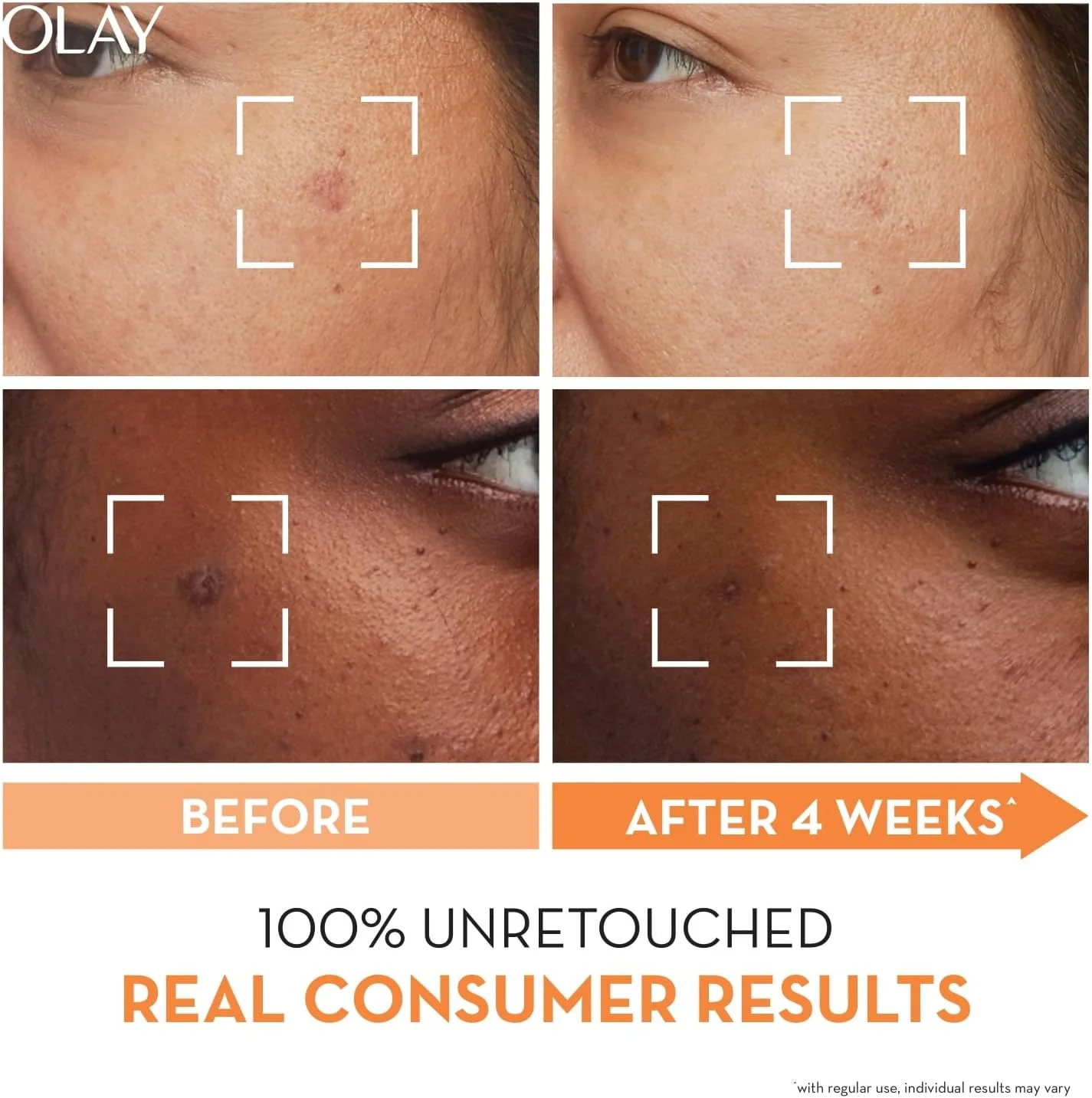 سرم فوق العاده لومینس اولای: سرم روشن کننده پوست حاوی نیاسینامید + ویتامین C برای پوستی یکدست و درخشان، فاقد سولفات و پارابن، 30 میلی لیتر سرم فوق العاده لومینس اولای: سرم روشن کننده پوست حاوی نیاسینامید + ویتامین C برای پوستی یکدست و درخشان، فاقد سولفات و پارابن، 30 میلی لیتر