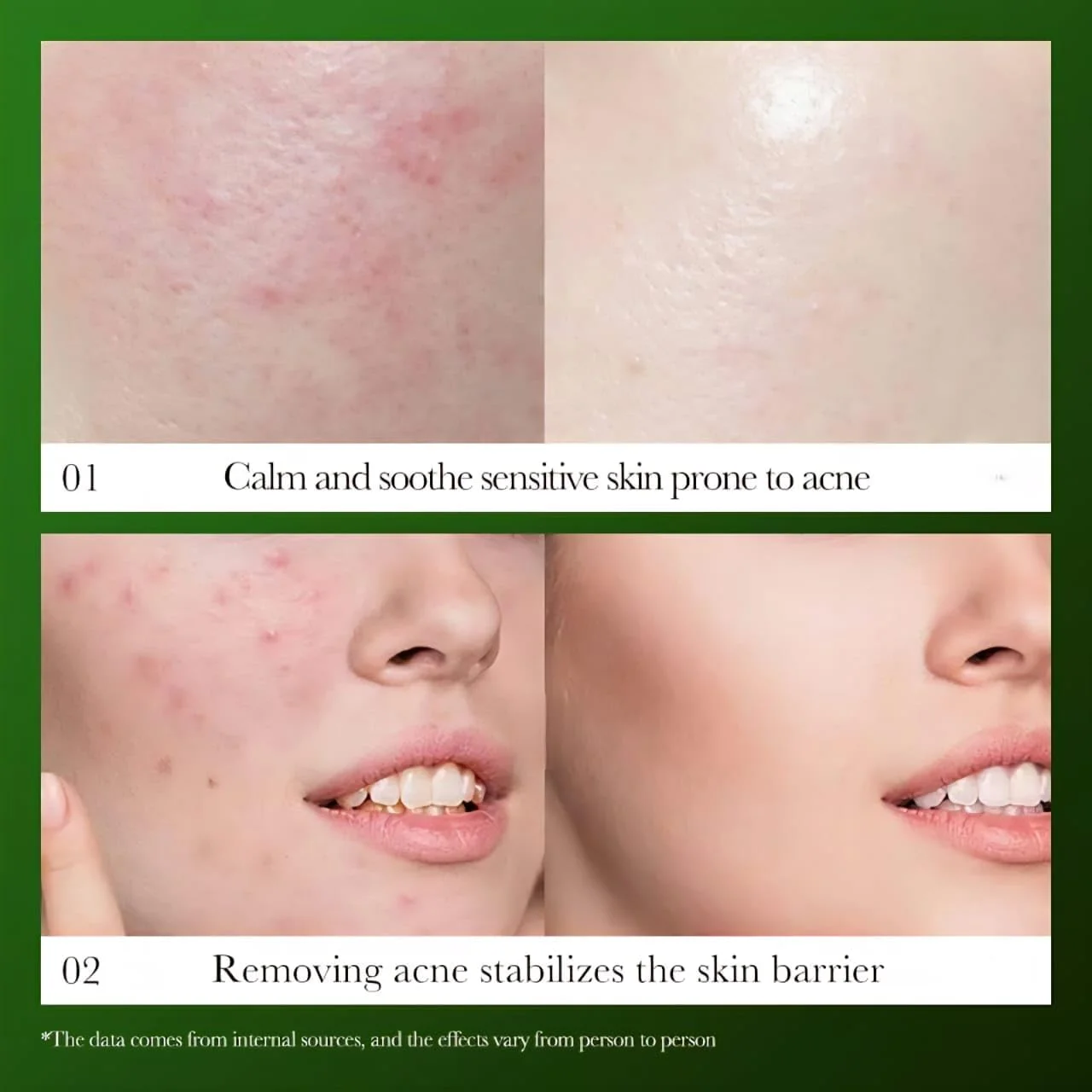 سرم ترمیم کننده و تسکین دهنده هوتونیا کورداتا با ویتامین C، آلوئه ورا و آربوتین - اسانس کوچک کننده منافذ، مرطوب کننده برای پوست حساس، ترمیم کننده سد دفاعی پوست، روشن کننده و آبرسان، حجم 30 میلی لیتر