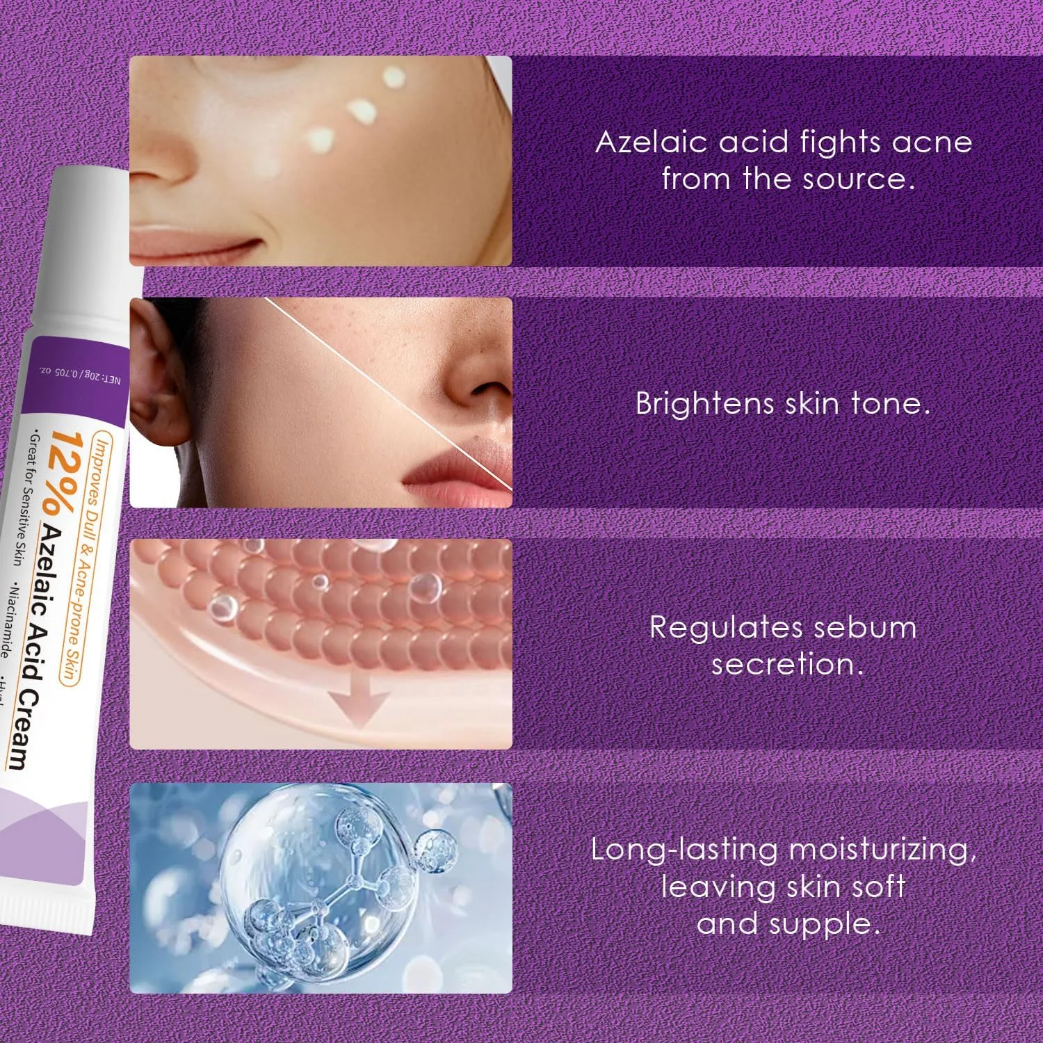 کرم 12% آزلائیک اسید - سرم صورت برای کاهش لکههای تیره، قرمزی، پوست چرب و مستعد جوش - حاوی نیاسینامید و هیالورونیک اسید، 20 گرم کرم 12% آزلائیک اسید - سرم صورت برای کاهش لکههای تیره، قرمزی، پوست چرب و مستعد جوش - حاوی نیاسینامید و هیالورونیک اسید، 20 گرم