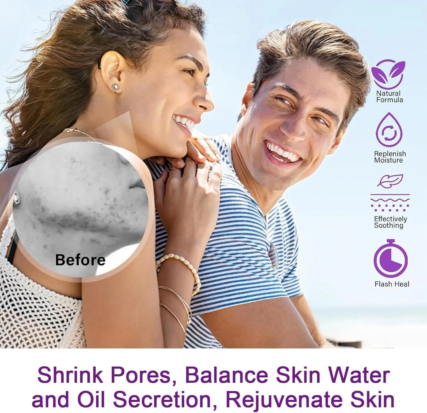 سرم اسید آزلائیک HIQUAY، کرم تقویت کننده 12% اسید آزلائیک، سرم اسید هیالورونیک و درمان صورت نیاسینامید، برای قرمزی، لکه های تیره، و پاکسازی منافذ (1 عدد)