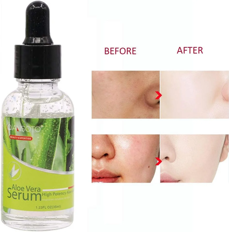 سرم صورت آلوئه ورا آبرسان ضد چروک ضد پیری رفع آکنه تسکین دهنده و ترمیم کننده پوست
