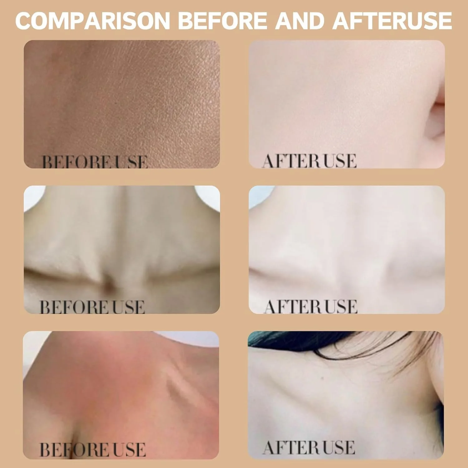 کره بدن نارگیل 300 گرمی، کرم بدن روغن نارگیل طبیعی، مرطوب کننده بدن برای مراقبت از پوست، تغذیه کننده، تسکین دهنده، آبرسان و ایجاد پوستی ابریشمی