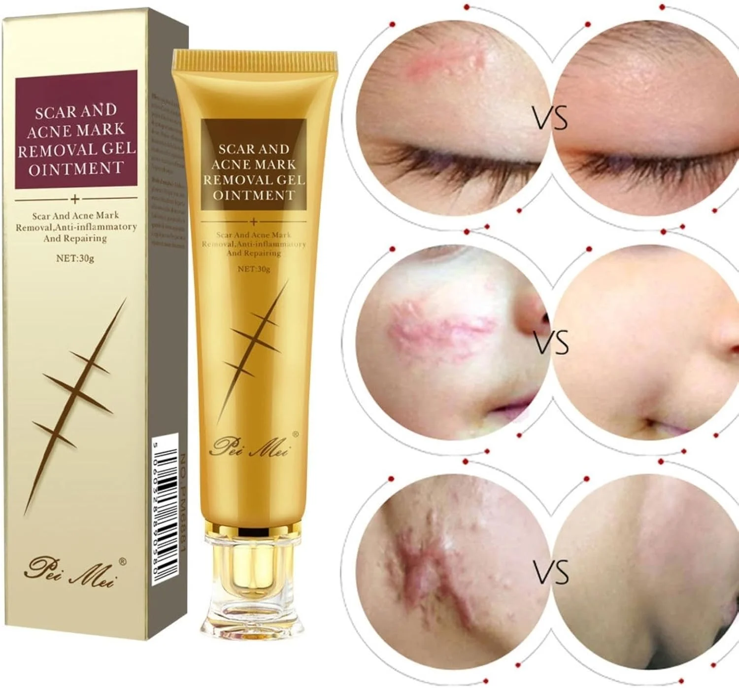 کرم ترمیم کننده جای زخم، ژل ترمیم کننده جای زخم، اسانس ترمیم کننده جای زخم 30 میلی لیتر، مرطوب کننده با جذب سریع، حاوی عصاره های گیاهی و مواد طبیعی، بهبود خشکی پوست، غیر چرب، استفاده آسان، مناسب برای انواع پوست