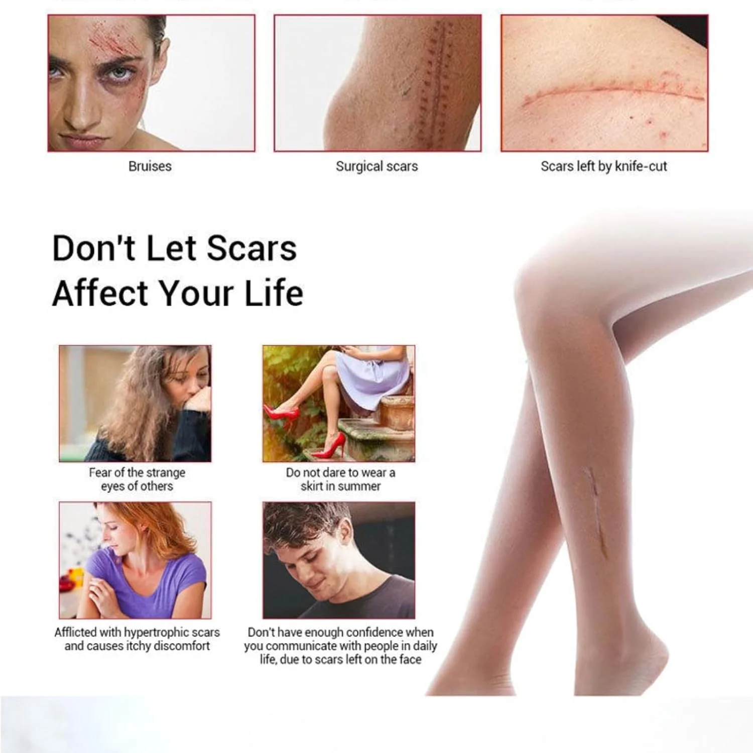 کرم ترمیم کننده جای زخم، ژل ترمیم کننده جای زخم، اسانس ترمیم کننده جای زخم 30 میلی لیتر، مرطوب کننده با جذب سریع، حاوی عصاره های گیاهی و مواد طبیعی، بهبود خشکی پوست، غیر چرب، استفاده آسان، مناسب برای انواع پوست