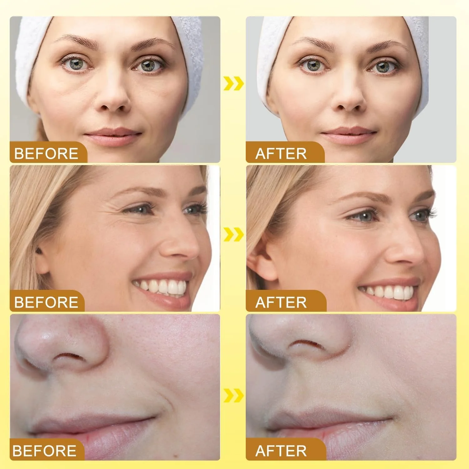 کرم زهر زنبور عسل - رفع چین و چروک و سفت کننده، مرطوب کننده، لیفتینگ و ترمیم کننده، کرم ترمیم کننده و مرطوب کننده عمیق برای انواع پوست (2 عدد) کرم زهر زنبور عسل - رفع چین و چروک و سفت کننده، مرطوب کننده، لیفتینگ و ترمیم کننده، کرم ترمیم کننده و مرطوب کننده عمیق برای انواع پوست (2 عدد)