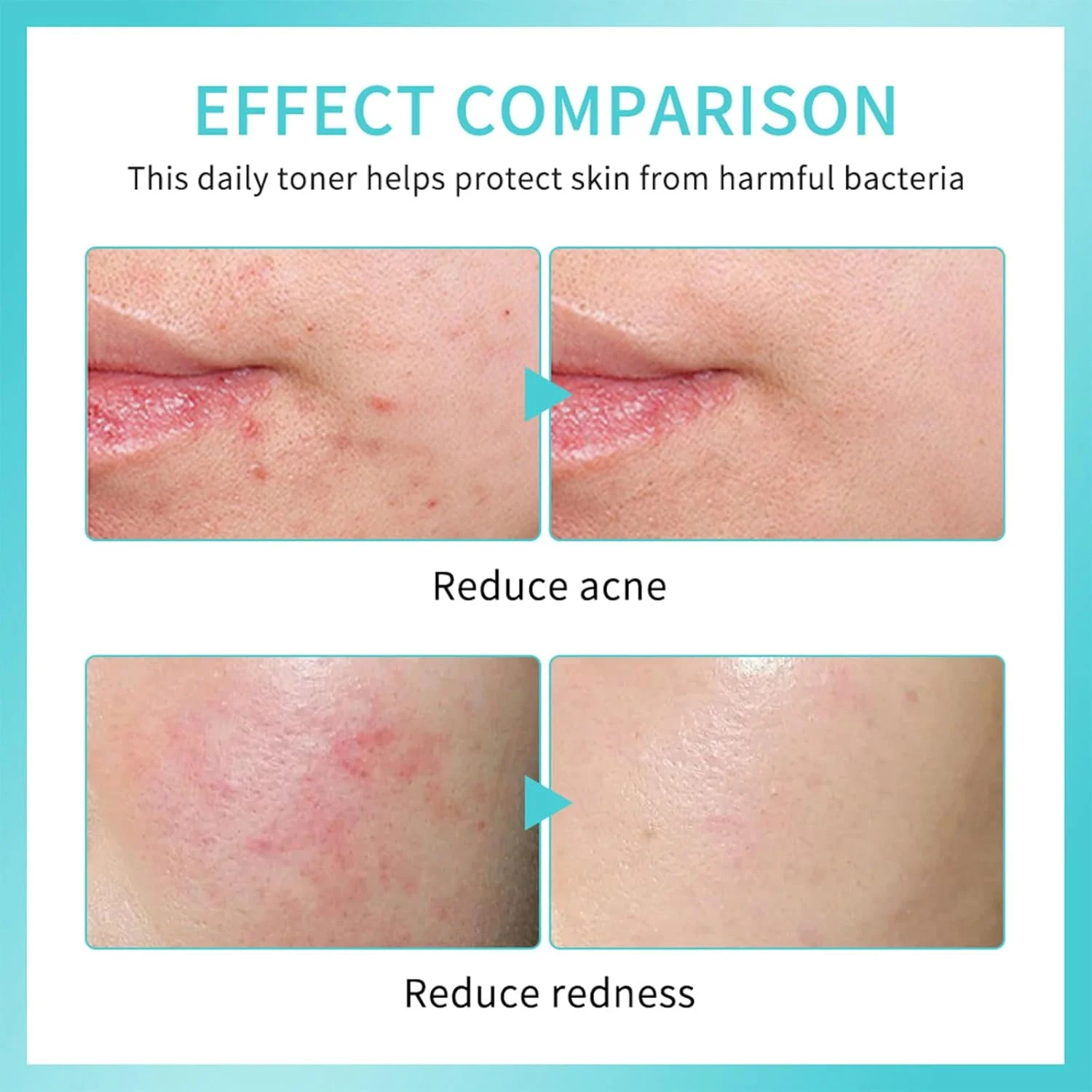 اسپری اسید هیپوکلروس برای صورت، اسپری روزانه نجات دهنده صورت، تونر تسکین دهنده و پاک کننده، مه صورت، پشتیبانی در برابر تحریک، آرام کننده قرمزی اسپری اسید هیپوکلروس برای صورت، اسپری روزانه نجات دهنده صورت، تونر تسکین دهنده و پاک کننده، مه صورت، پشتیبانی در برابر تحریک، آرام کننده قرمزی