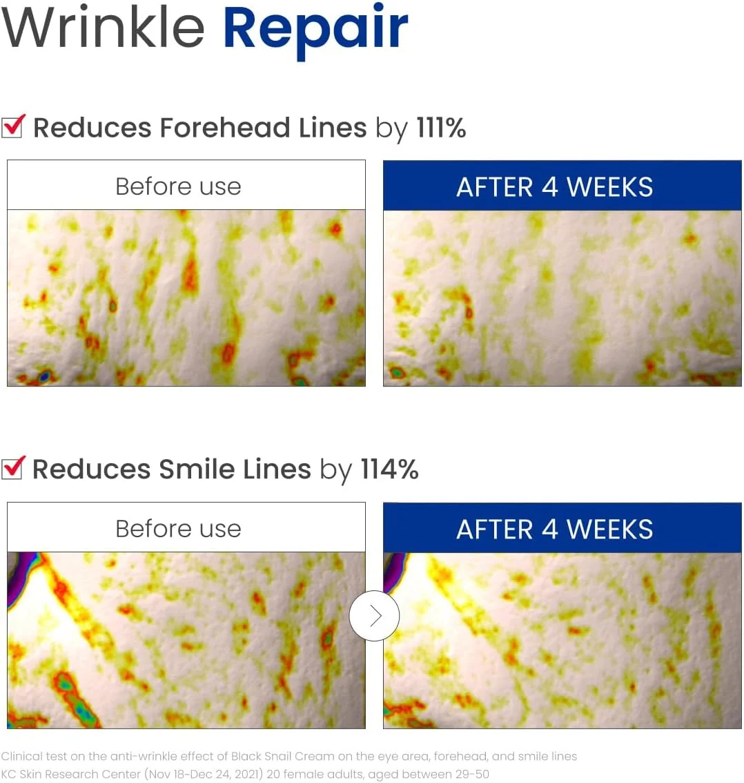 کرم حلزون سیاه دکتر جی، 50 میلی لیتر - مرطوب کننده موسین حلزون، سرم موسین حلزون، مرطوب کننده صورت، کرم صورت مرطوب کننده، مراقبت از پوست کره ای، کی بیوتی