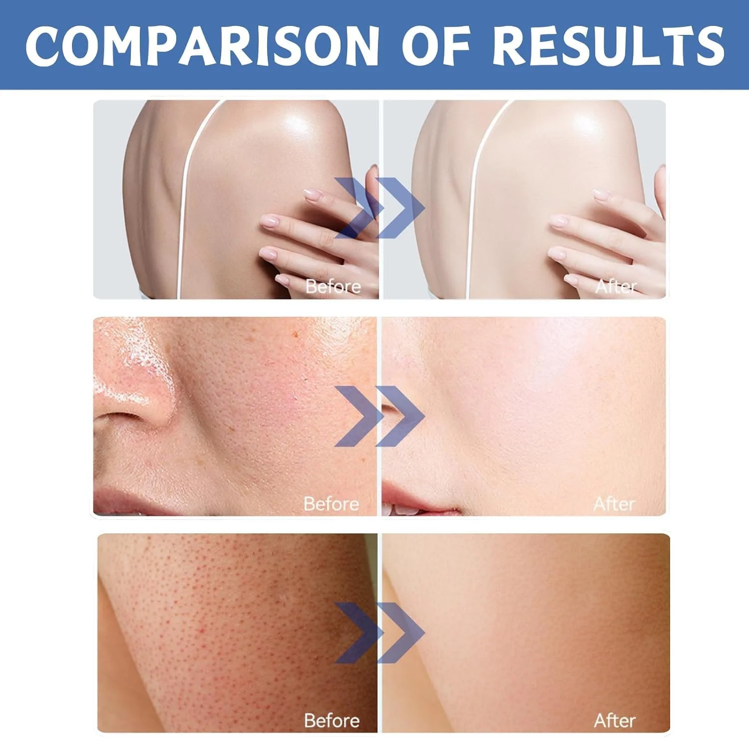 کرم مرطوب کننده صورت روغن نارگیل آزونی، کرم صورت مرطوب کننده با کلاژن و اسید هیالورونیک، کرم صورت برای پوست خشک، کرم کلاژن، ضد پیری، سفت کننده، مرطوب کننده شدید برای پوست خشک