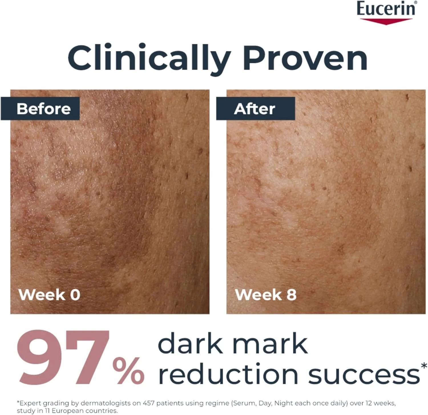 کرم روز صورت اوسرین Even Pigment Perfector حاوی تیامیدول، محافظت در برابر اشعه UVA و UVB، SPF 30، کاهش لکههای رنگدانهای و جلوگیری از ظهور مجدد آنها، مرطوب کننده فوری برای انواع پوست، 50 میلی لیتر کرم روز صورت اوسرین Even Pigment Perfector حاوی تیامیدول، محافظت در برابر اشعه UVA و UVB، SPF 30، کاهش لکههای رنگدانهای و جلوگیری از ظهور مجدد آنها، مرطوب کننده فوری برای انواع پوست، 50 میلی لیتر